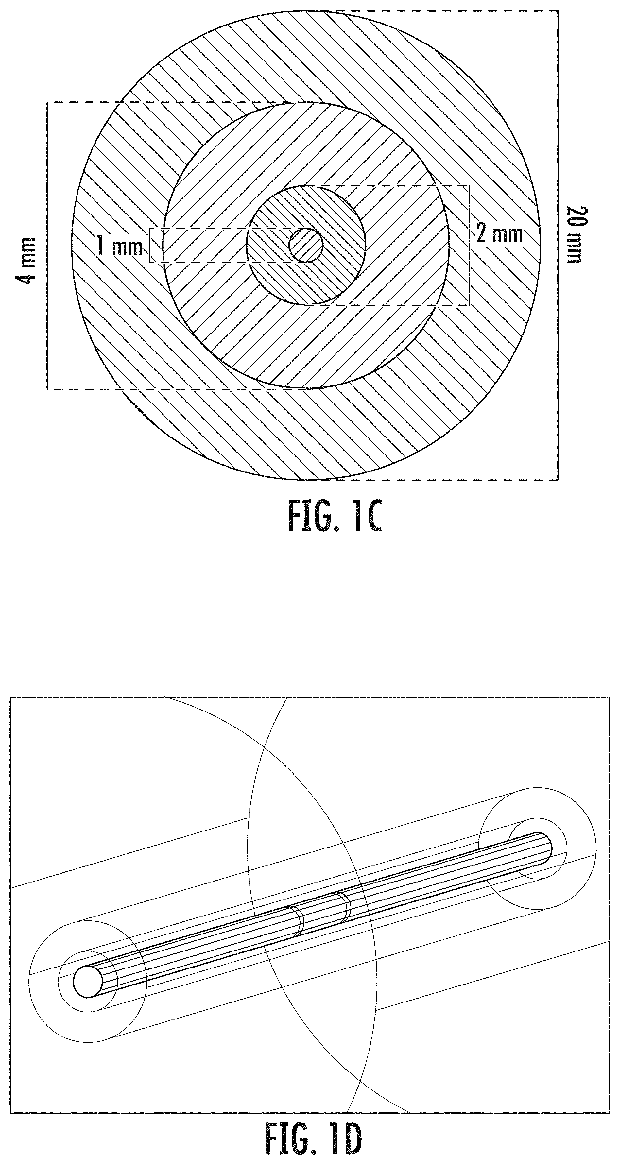 Device and method for electroporation based treatment of stenosis of a tubular body part