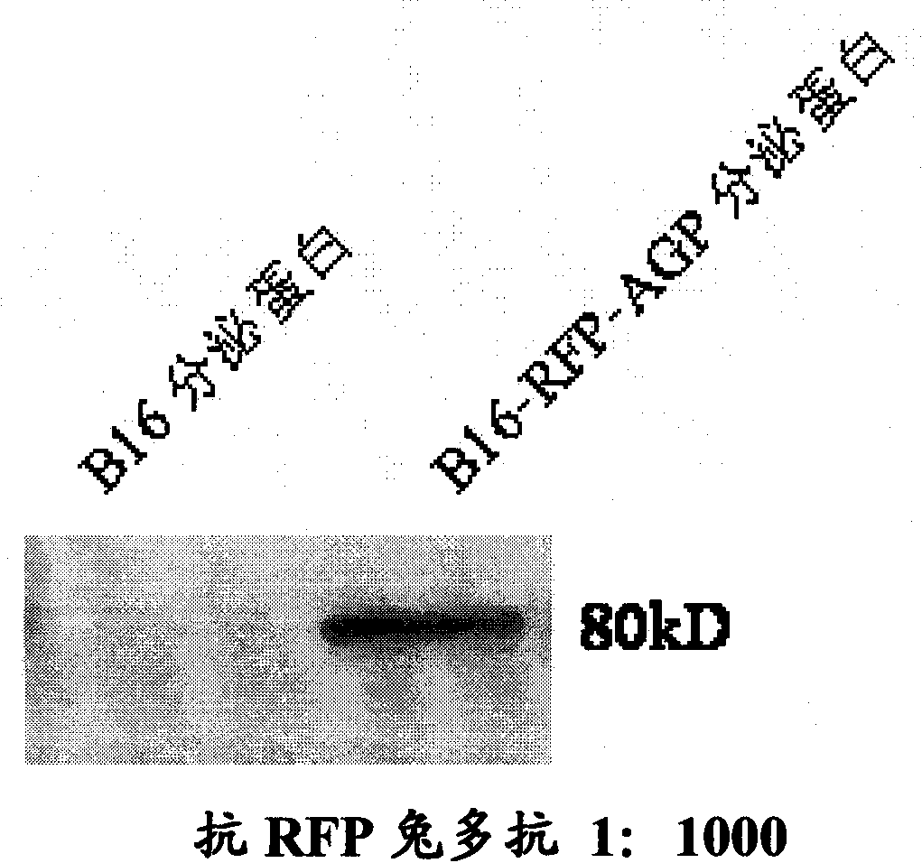 Monoclonal antibody against human alpha1 acid glycoprotein and preparation method thereof