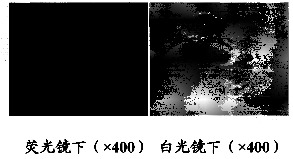 Monoclonal antibody against human alpha1 acid glycoprotein and preparation method thereof