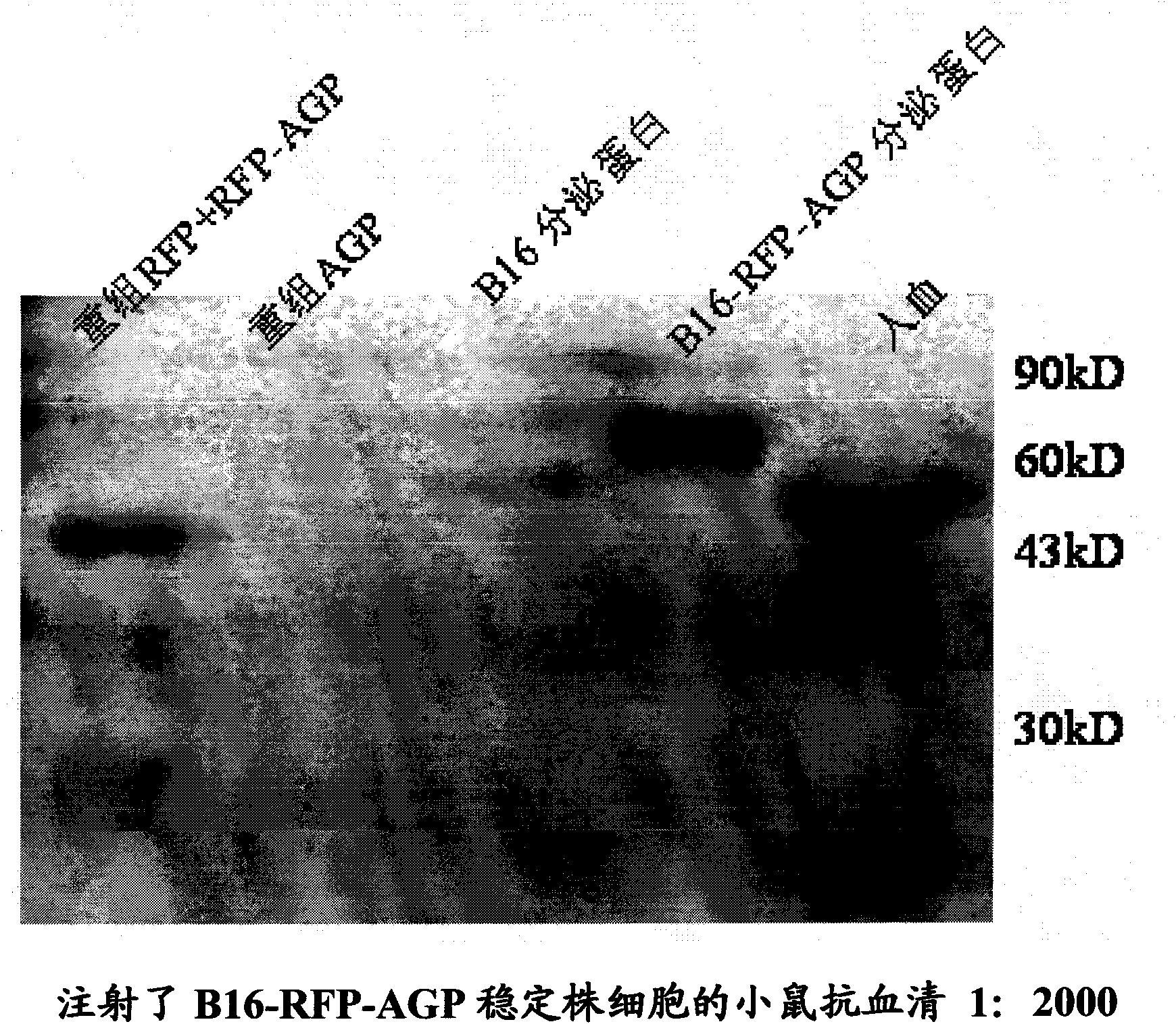 Monoclonal antibody against human alpha1 acid glycoprotein and preparation method thereof