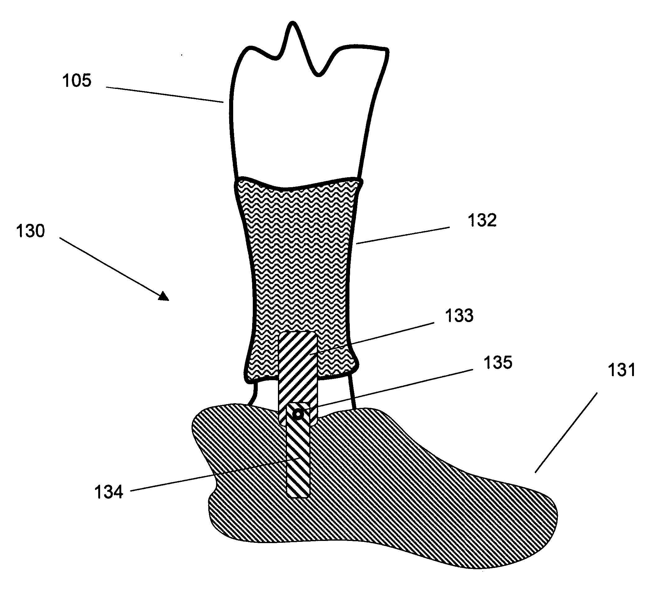 Walk-assist devices and methods