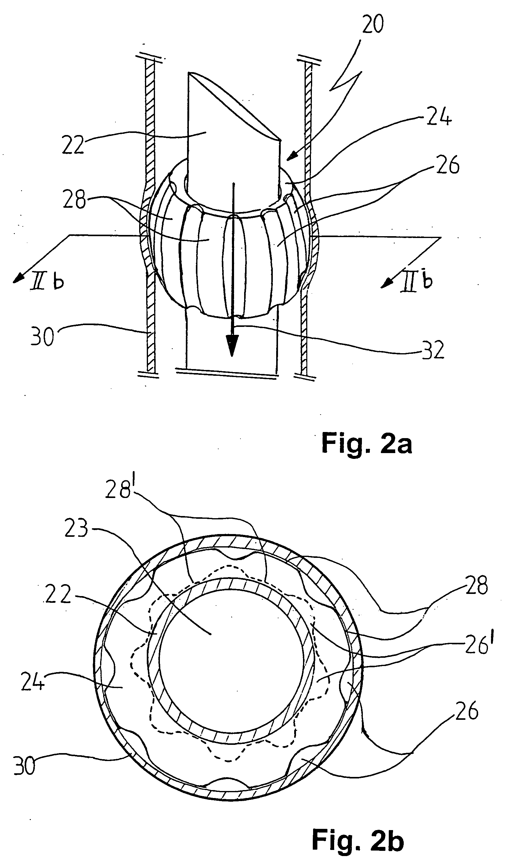 Appliance for cannulation of a blood vessel