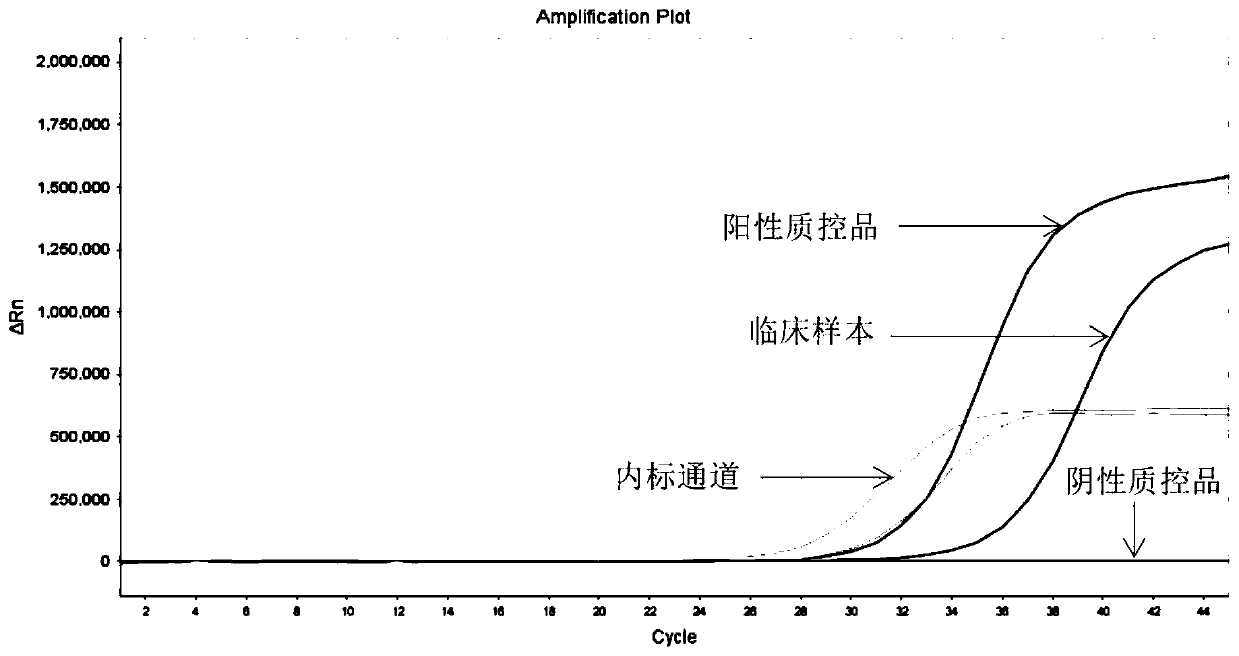 Kit and method for multiple detection of ALK gene mutation