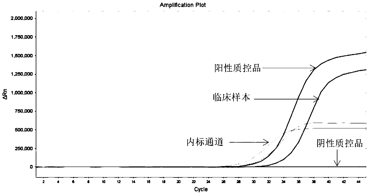 Kit and method for multiple detection of ALK gene mutation