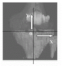 Method for virtually building anterior cruciate ligament on femur and tibia tunnels