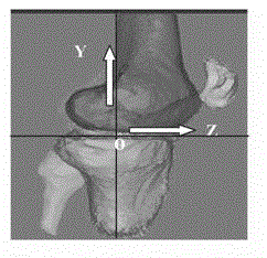 Method for virtually building anterior cruciate ligament on femur and tibia tunnels
