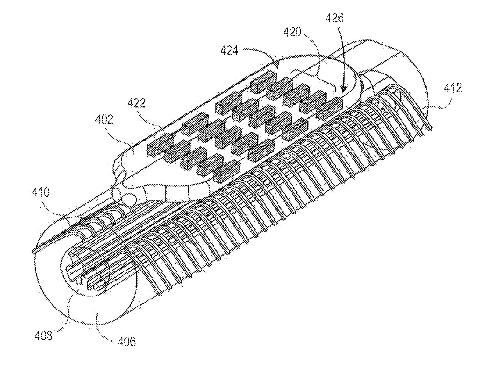System and method for dorsal root block during spinal cord stimulation