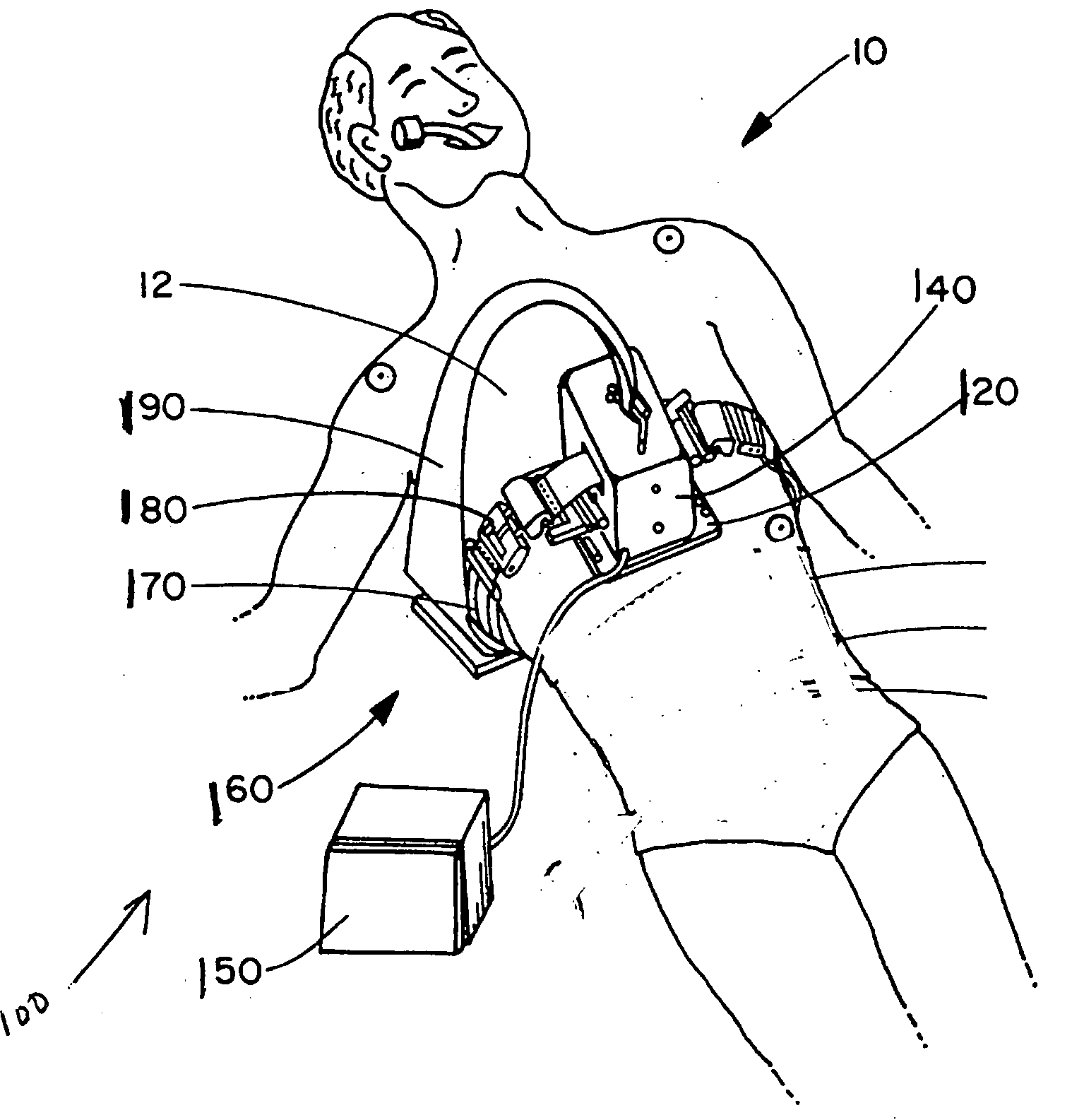 Optimal control of CPR procedure