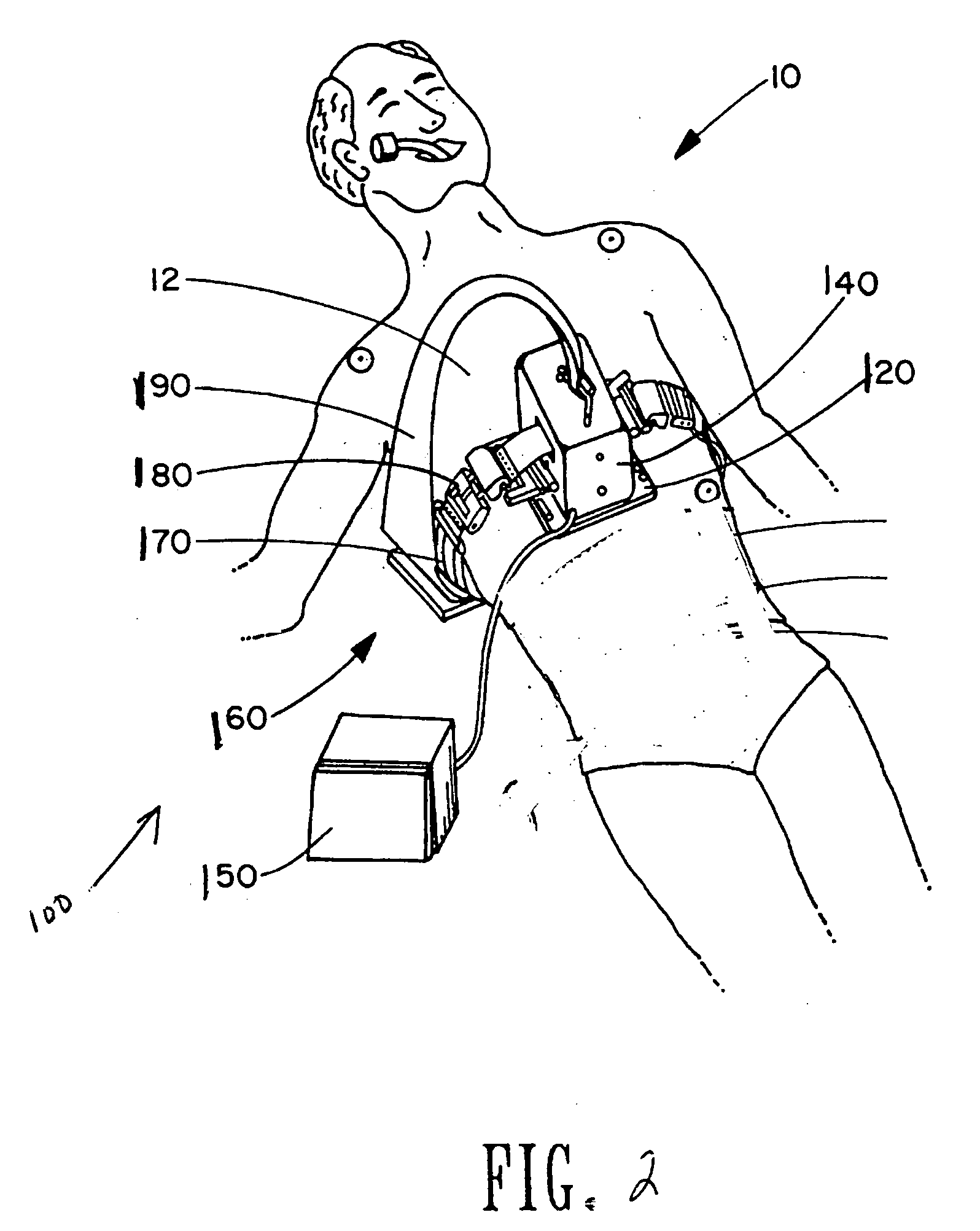 Optimal control of CPR procedure