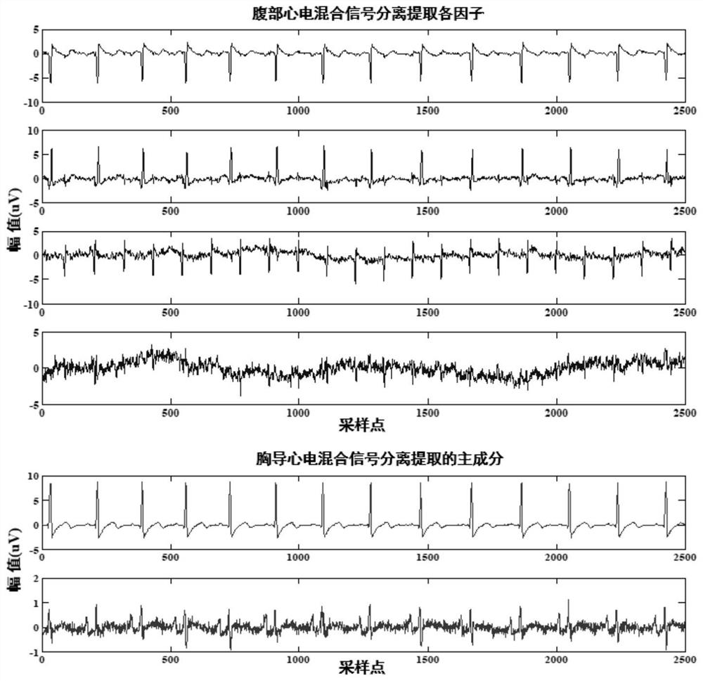 Multi-lead fetal electrocardiogram extraction device based on factor synchronism analysis