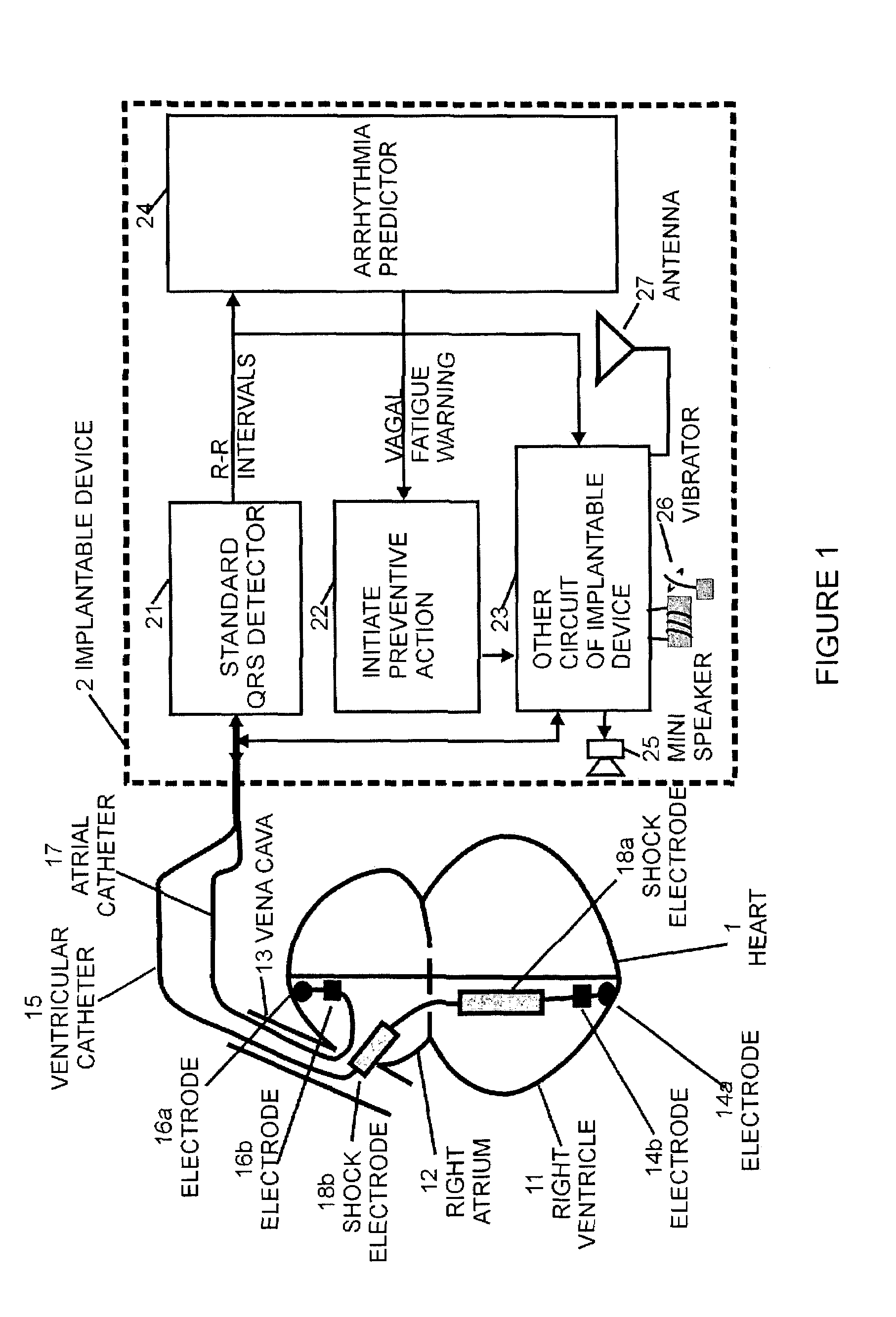 Method and apparatus for preventing heart tachyarrhythmia