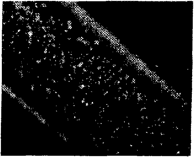 Bioabsorbable medical device with coating