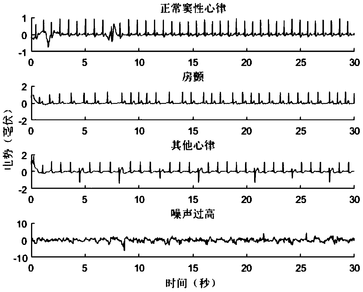 Arterial fibrillation detecting method based on single lead electrocardiosignal time-frequency characteristic