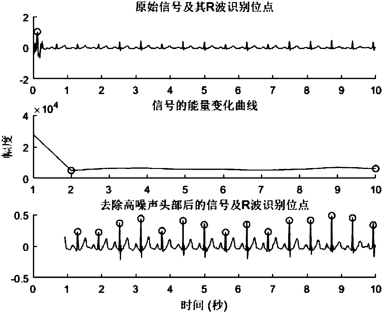 Arterial fibrillation detecting method based on single lead electrocardiosignal time-frequency characteristic