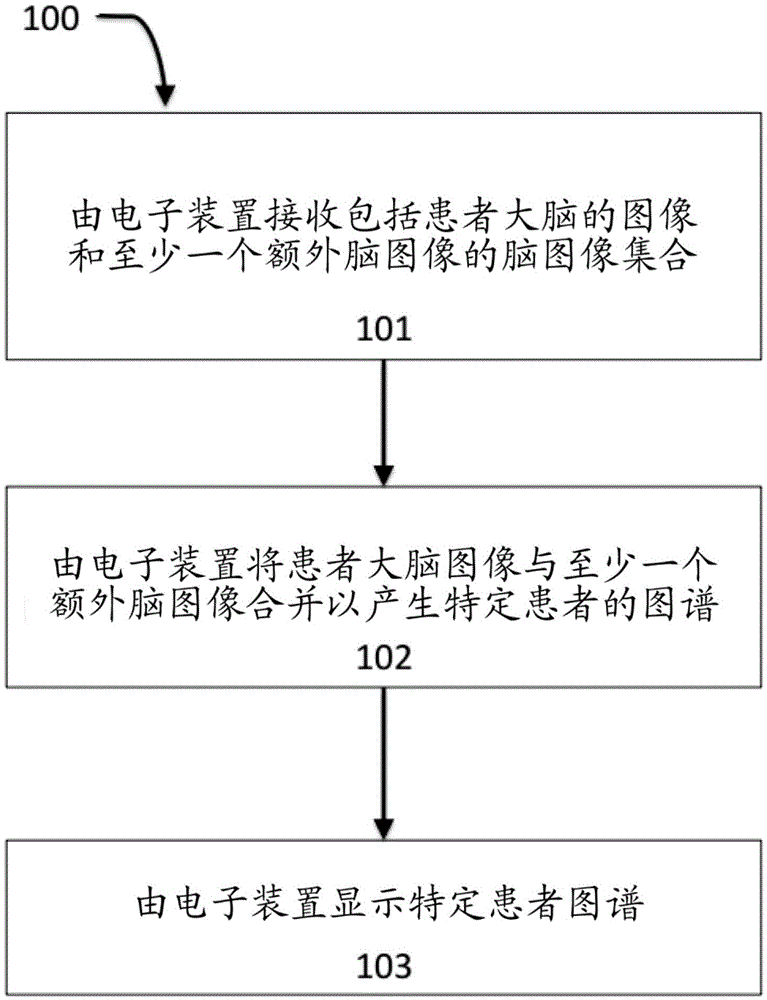 Method and system for a brain image pipeline and brain image region location and shape prediction