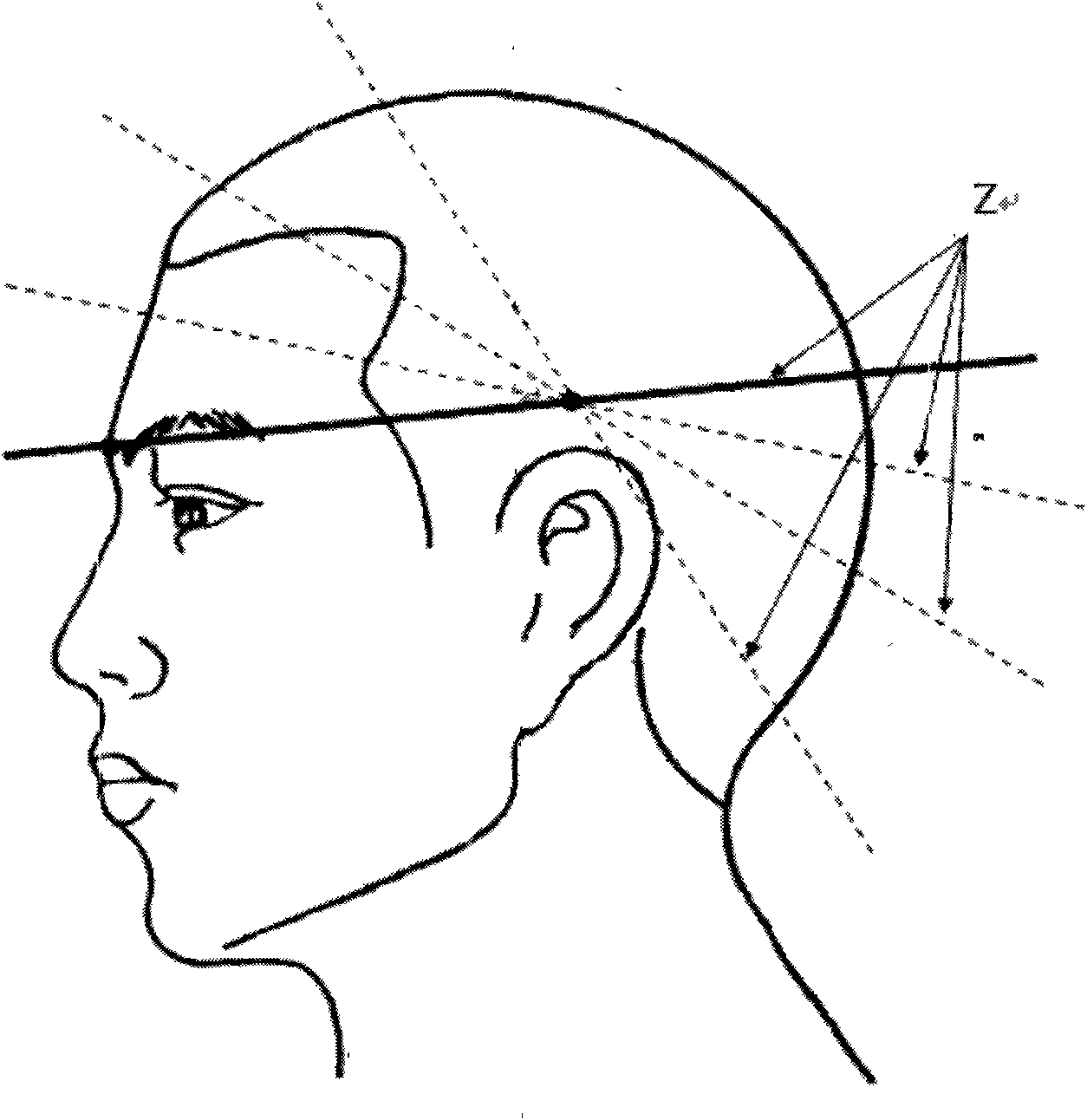 Transcranial magnetic therapeutic instrument for computer diseases