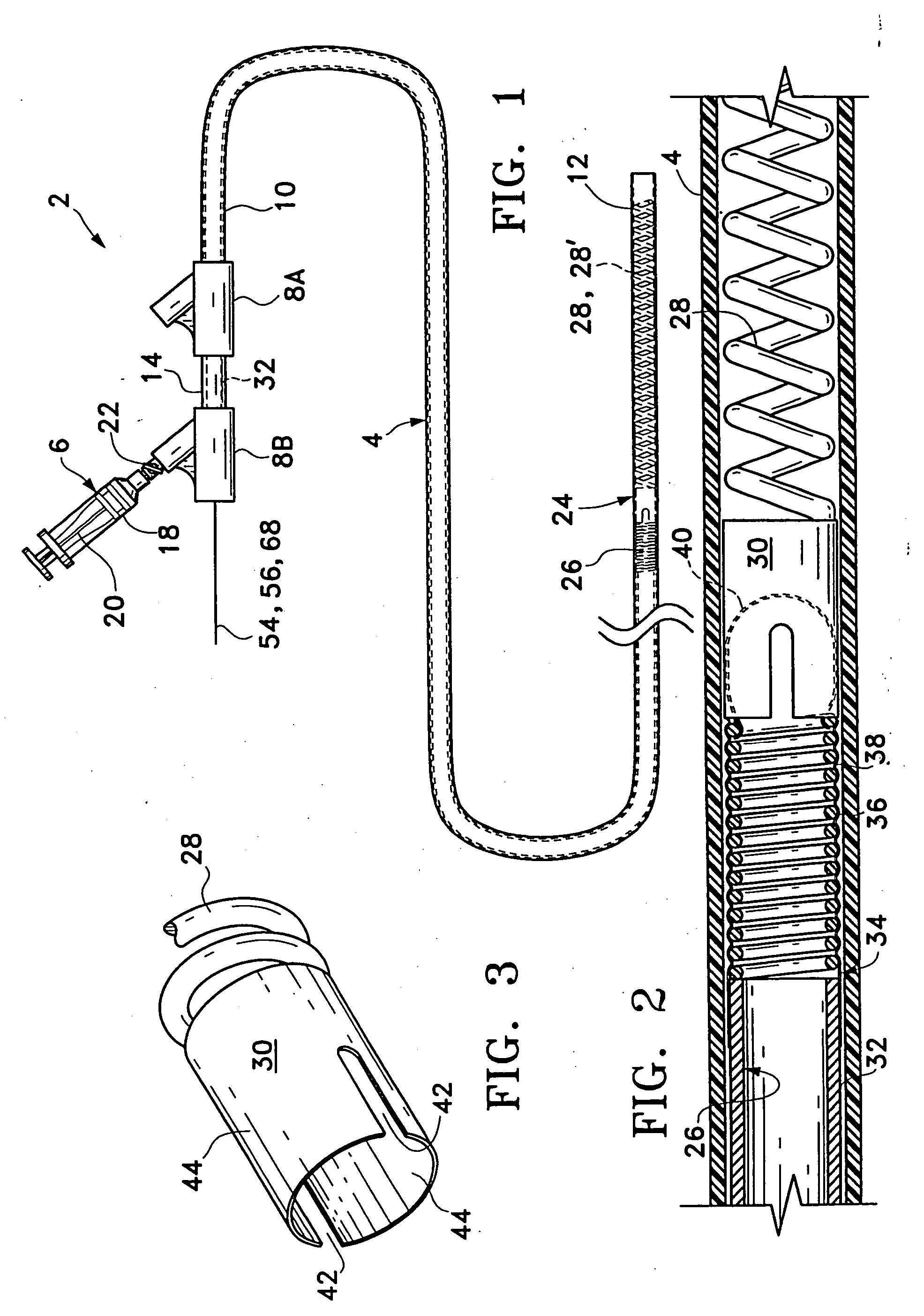 Implant delivery assembly with expandable coupling/decoupling mechanism