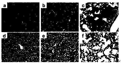 Medicinal application of astragalus polysaccharide in prevention and treatment of leptospirosis