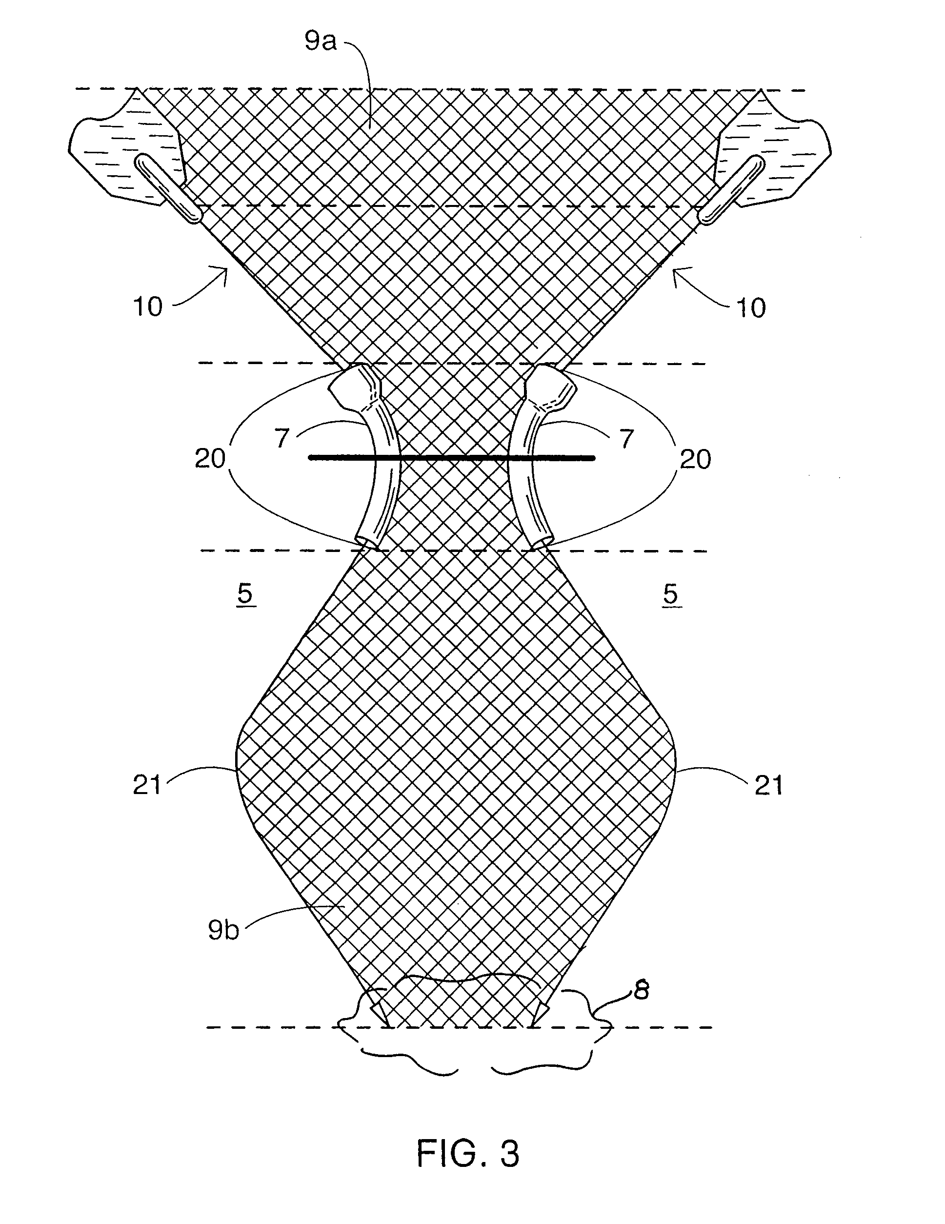 Laparoscopic instrument and trocar system and related surgical method