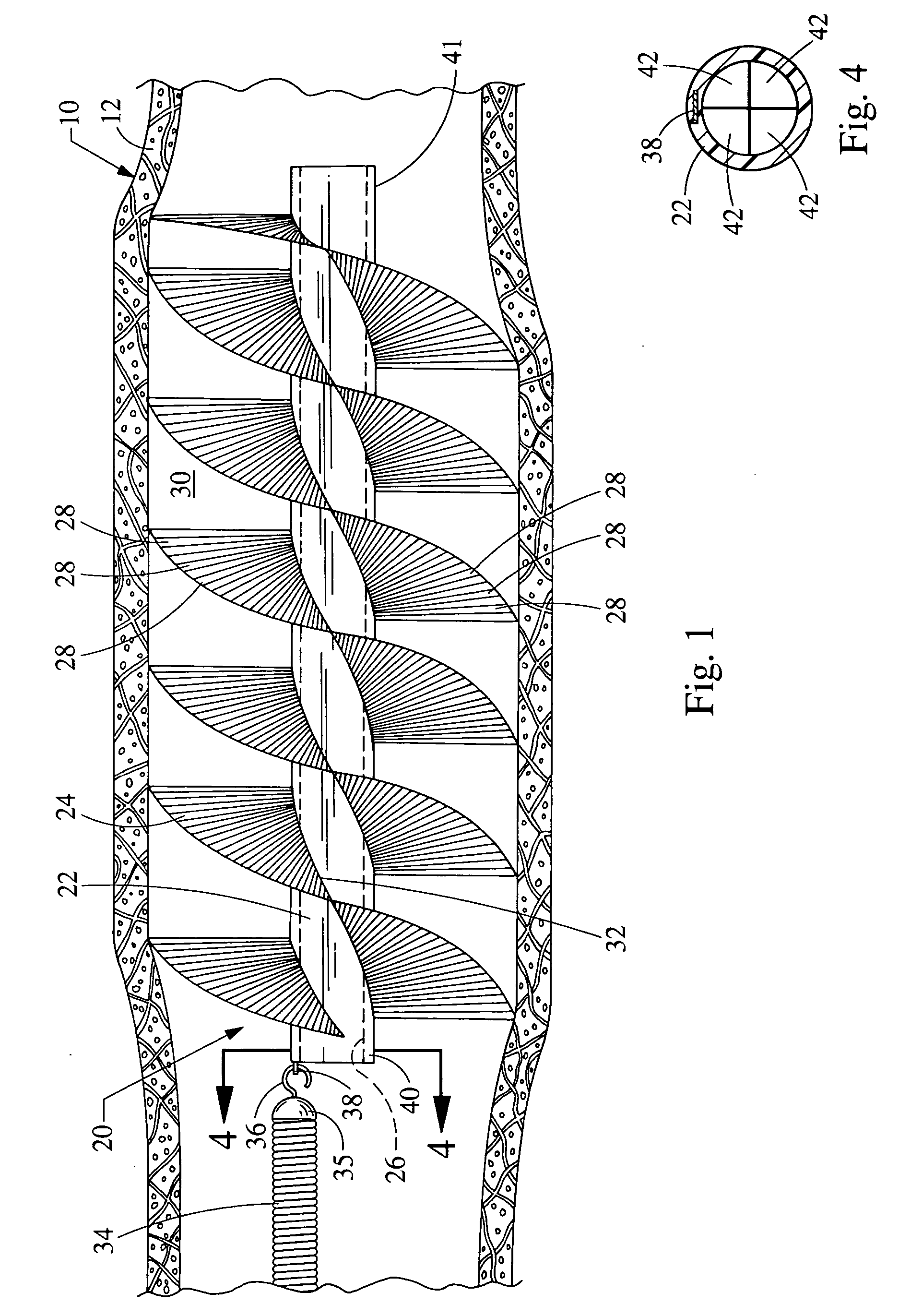 Embolic protection device