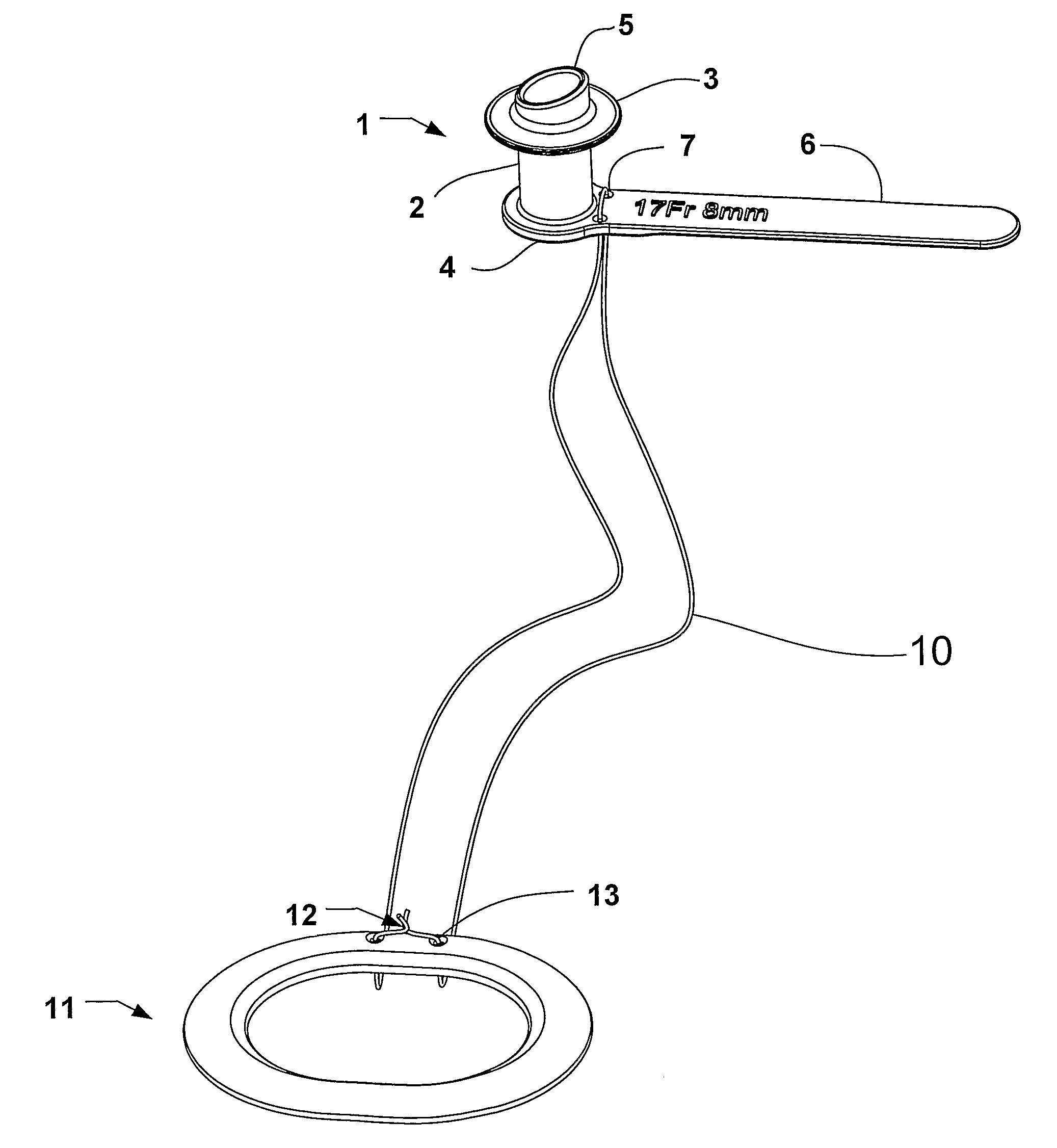 Voice prosthesis, insertion tool and method