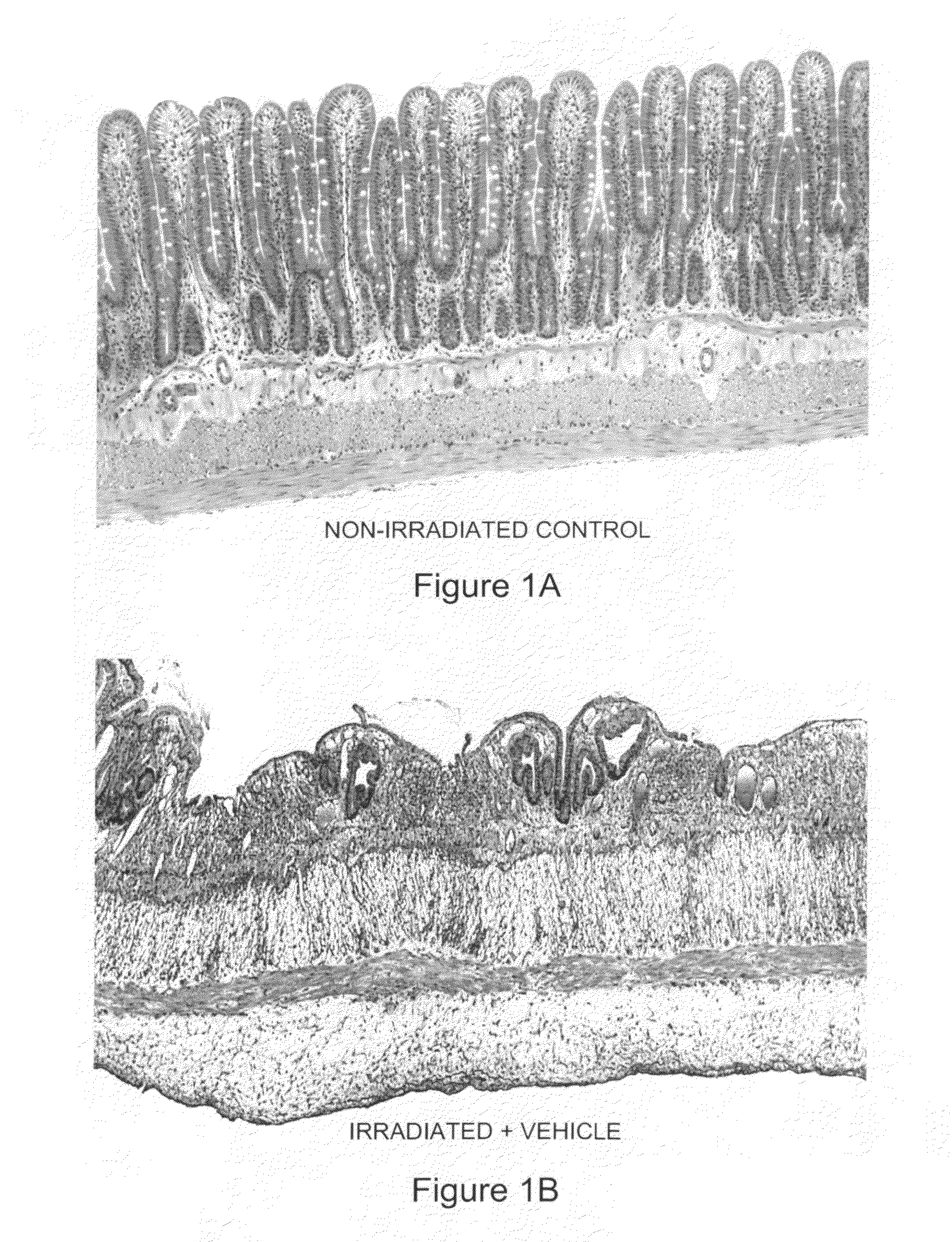 Methods and compositions useful in the treatment of mucositis