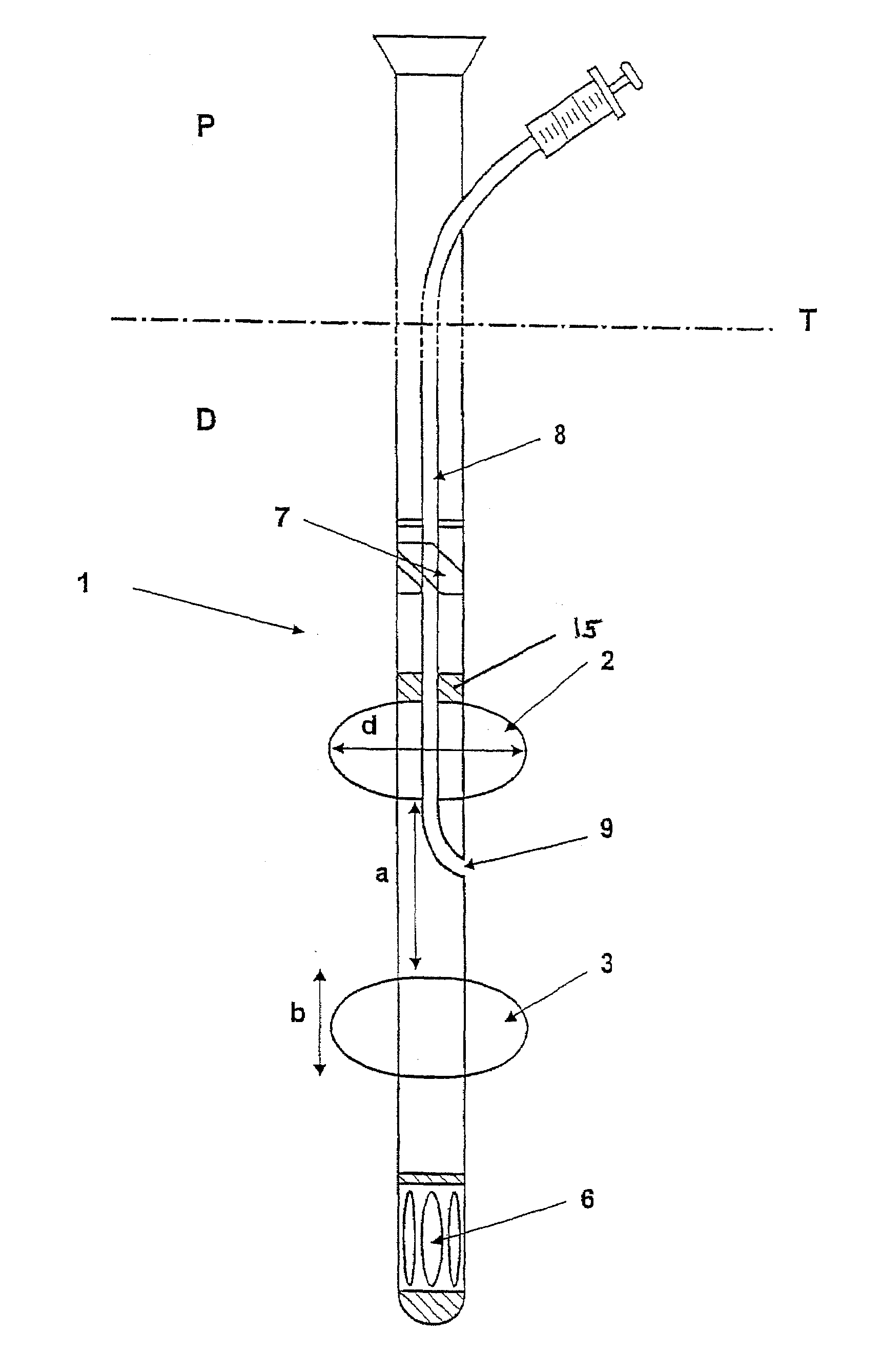 Device for minimally invasive intravascular aortic valve extraction