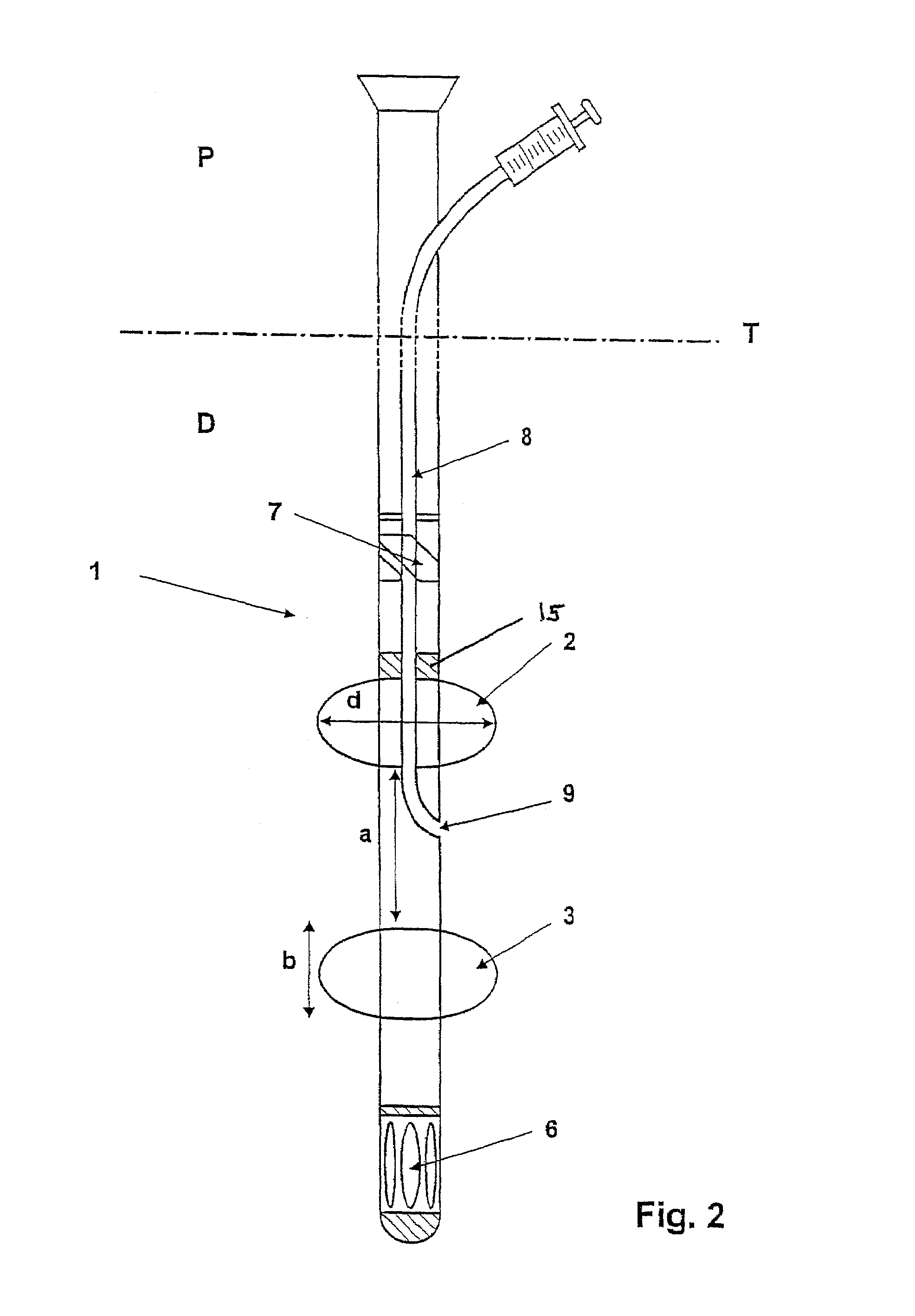 Device for minimally invasive intravascular aortic valve extraction