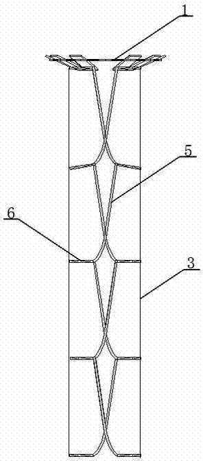 Self-stretching intra-esophageal stent capable of carrying local chemotherapy drugs