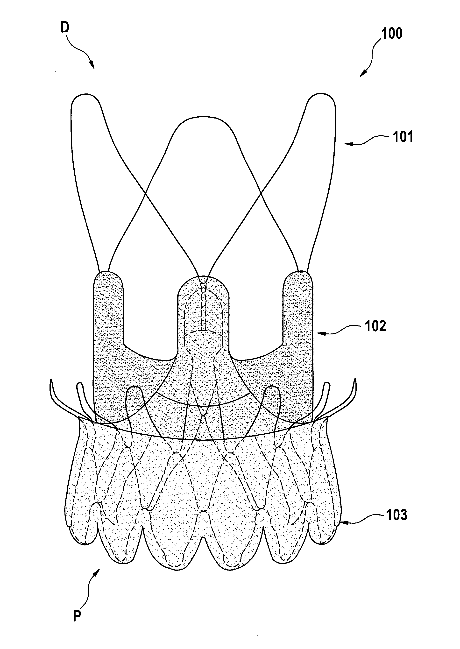 Aortic bioprosthesis and systems for delivery thereof