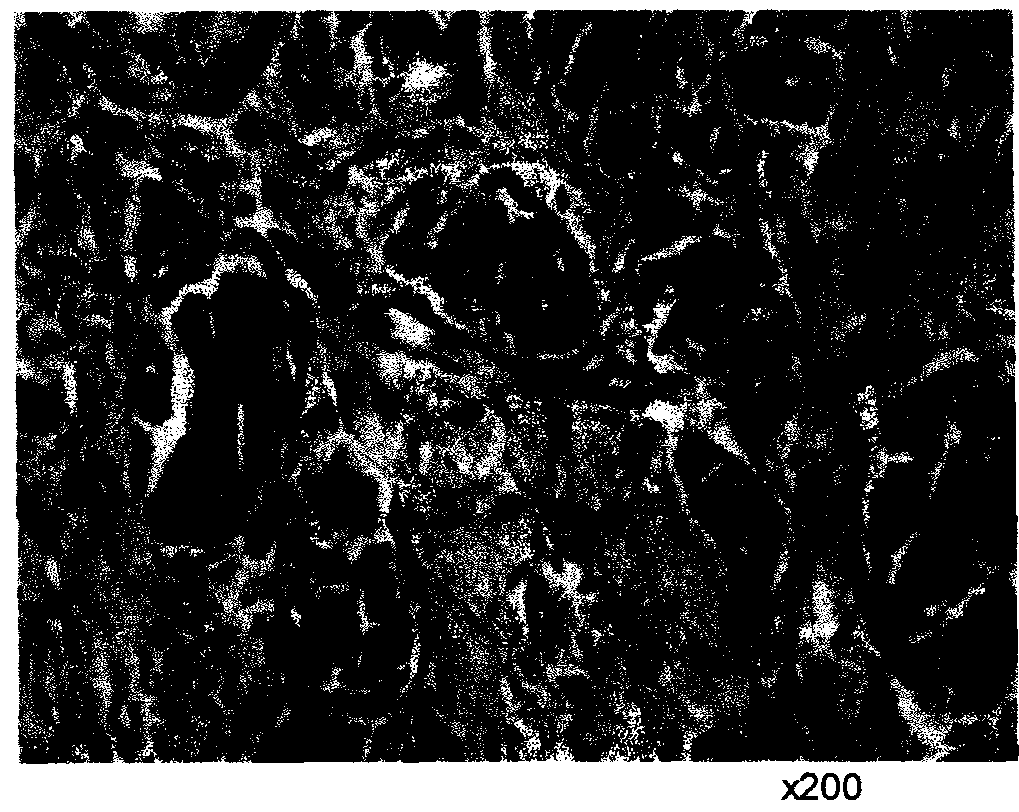 Composite containing collagen and elastin as a dermal expander and tissue filler