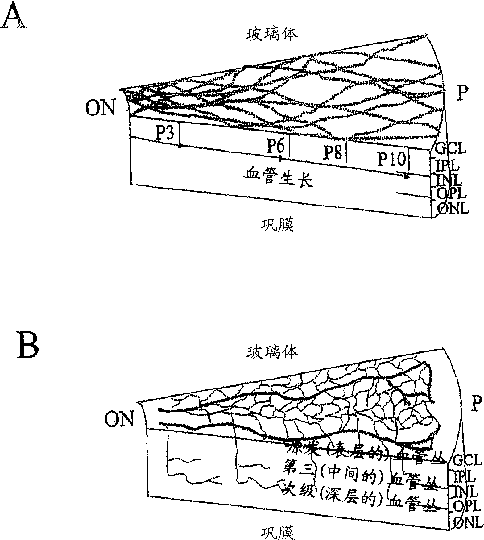 Hematopoietic stem cells and methods of treatment of neovascular eye diseases therewith