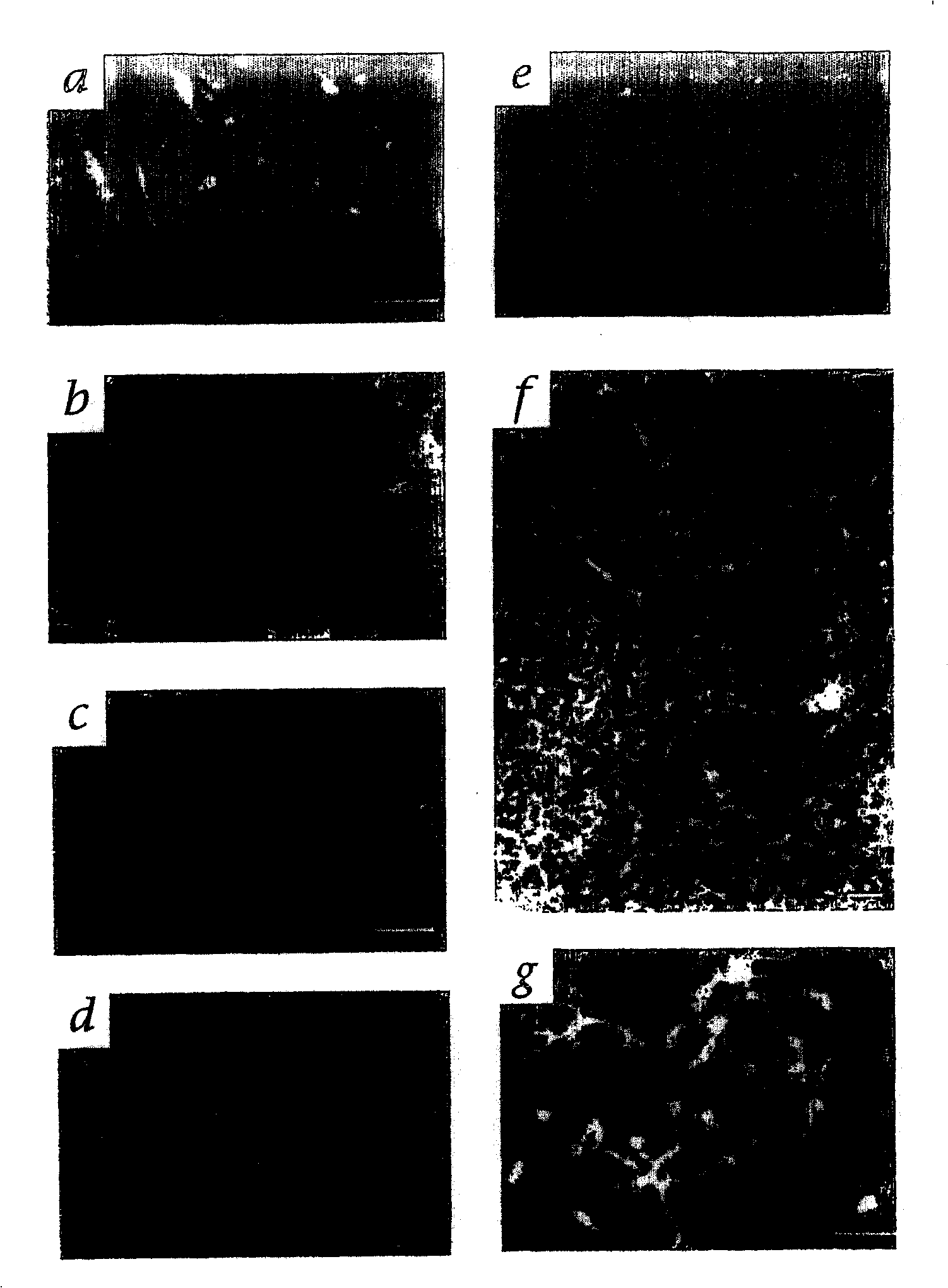 Hematopoietic stem cells and methods of treatment of neovascular eye diseases therewith