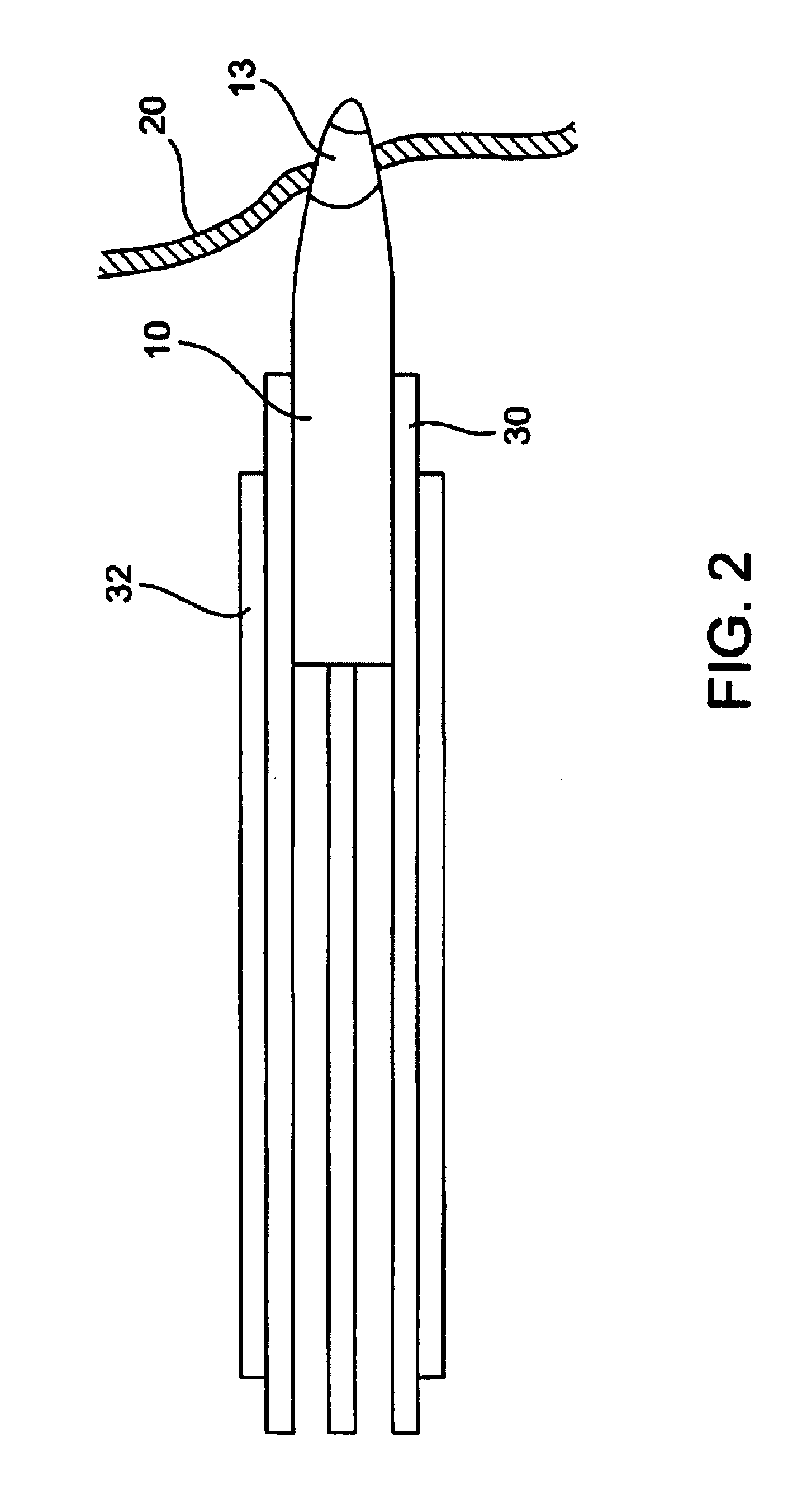 Nerve surveillance cannulae systems