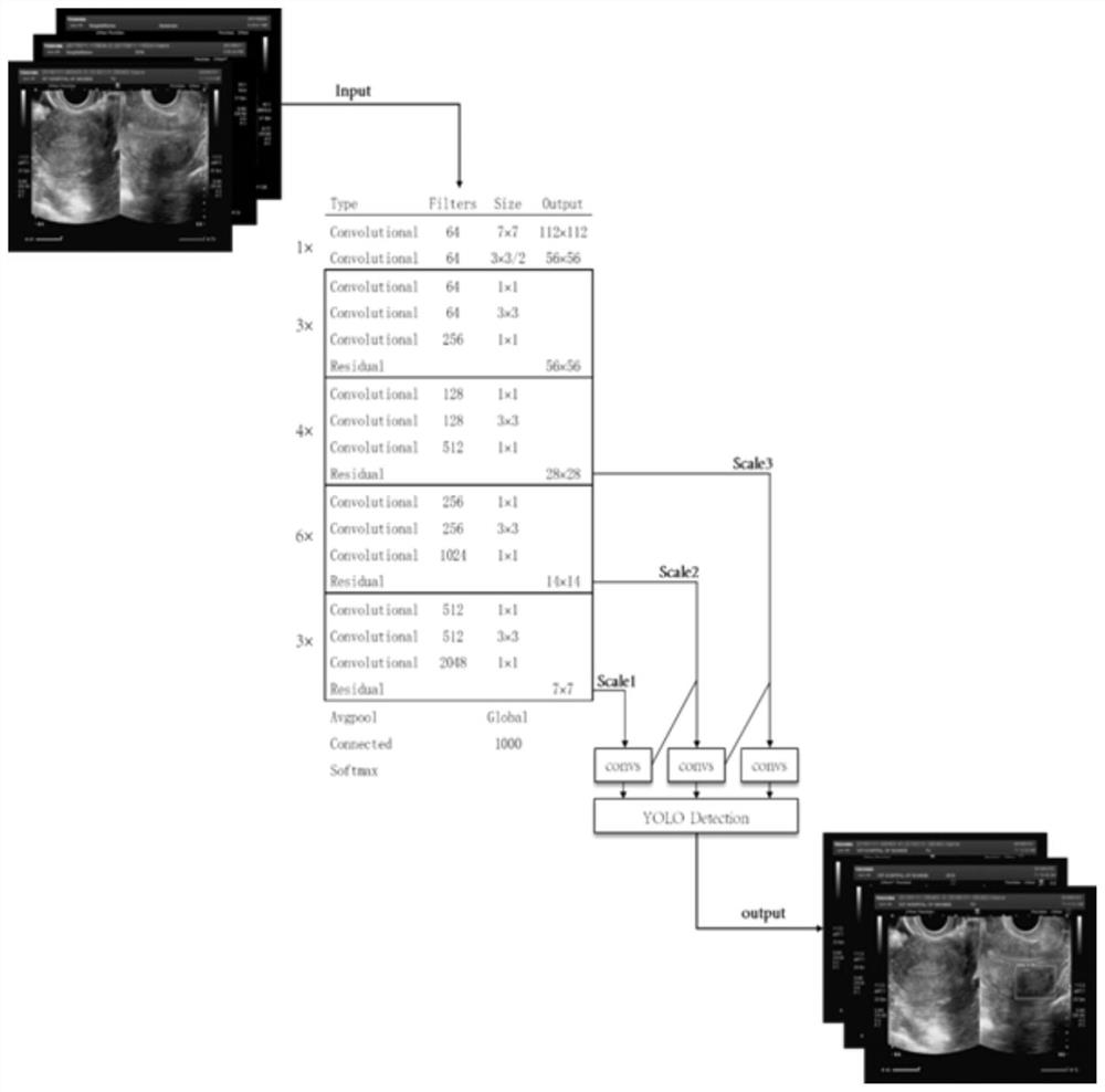 Uterine myoma target image acquisition method based on residual network structure