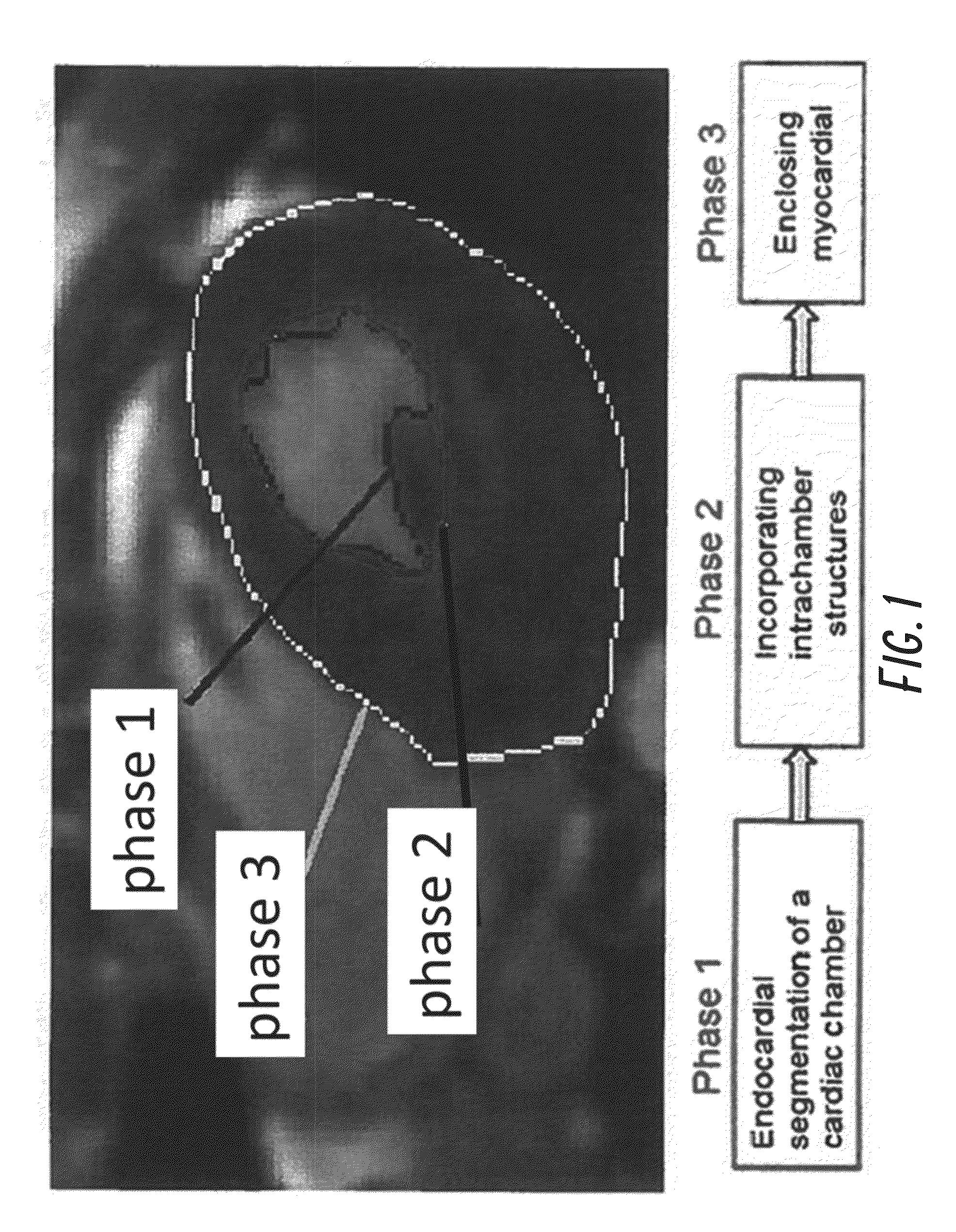 Automated 3D Reconstruction of the Cardiac Chambers from MRI and Ultrasound