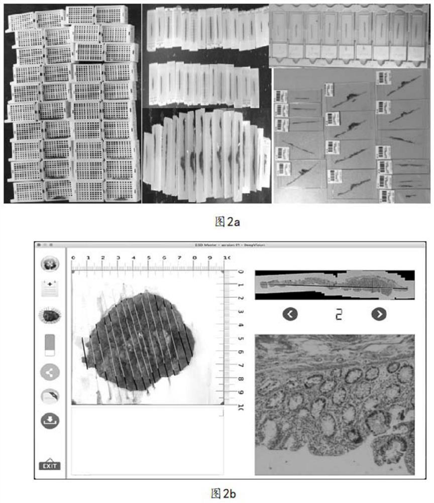 Application of pathological specimen manufactured by dehydration set in digital evaluation system