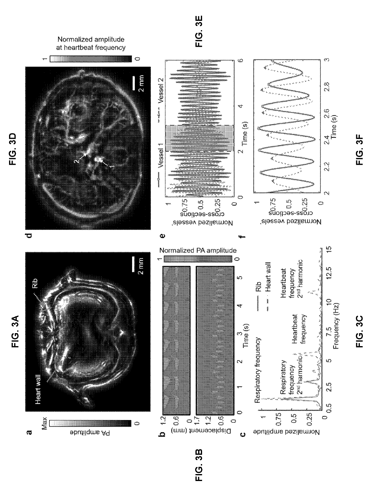 Single-impulse panoramic photoacoustic computed tomography (sip-pact)