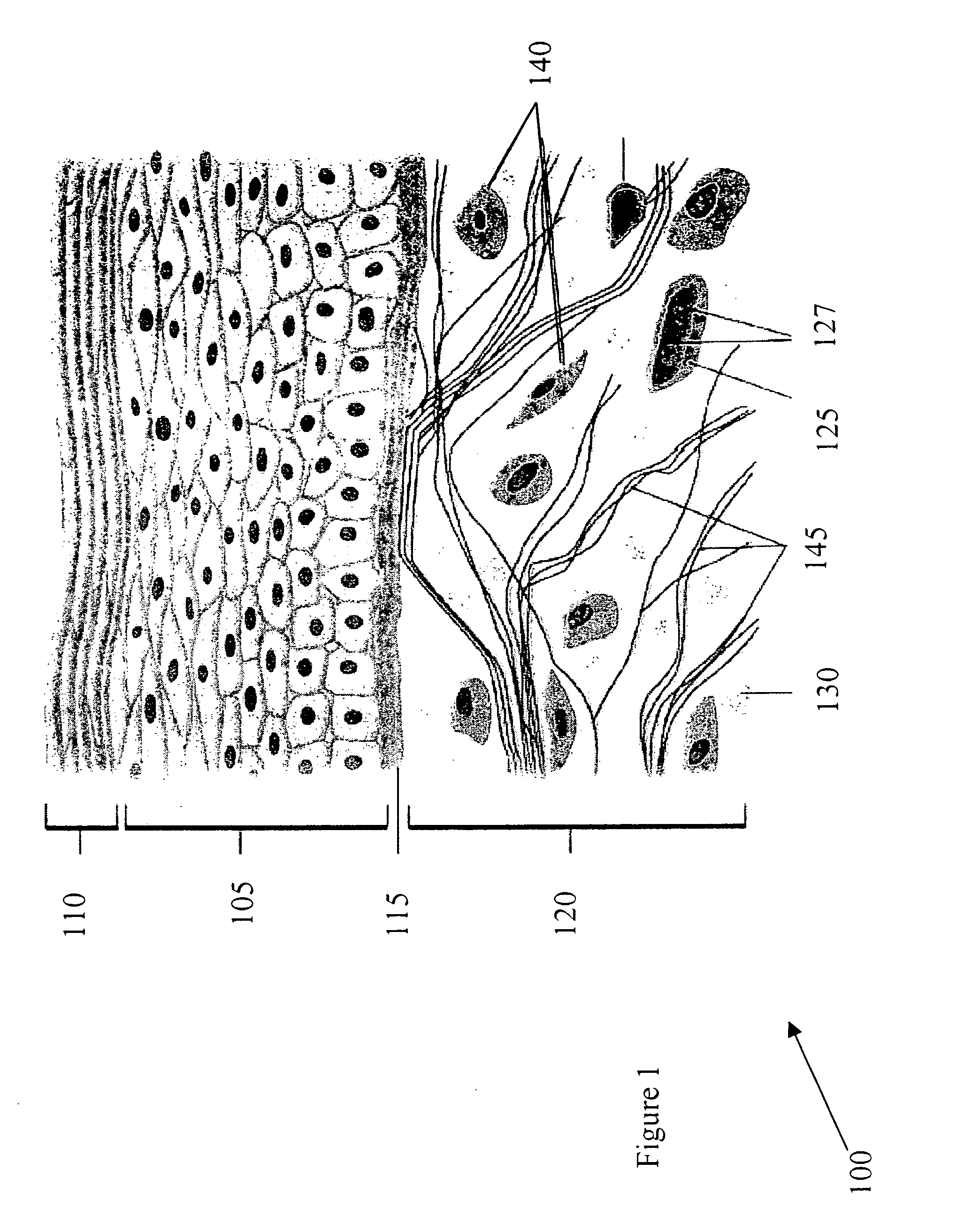 Device for optically stimulating collagen formation in tissue