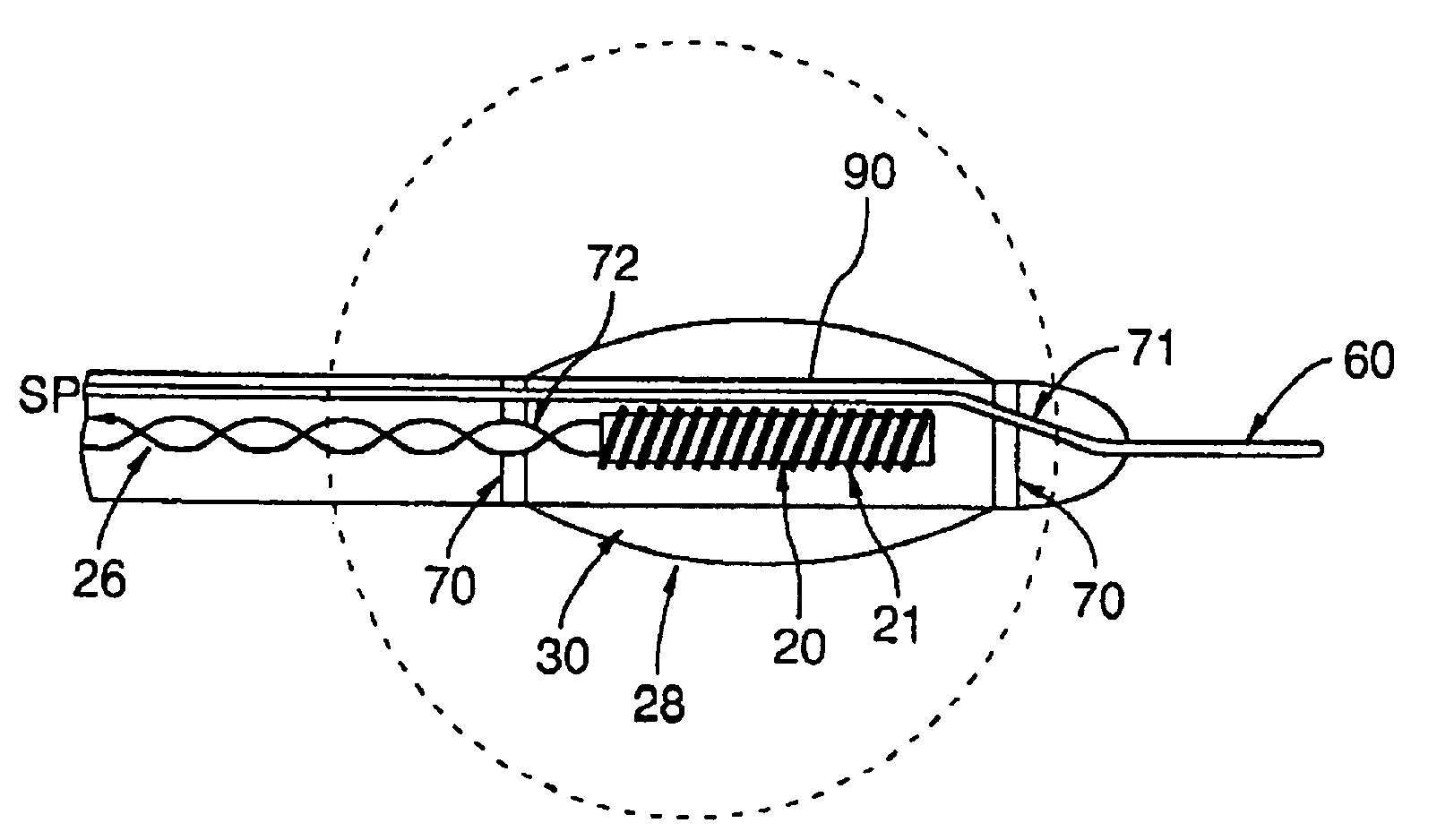 Device and method for registering a position sensor in an anatomical body