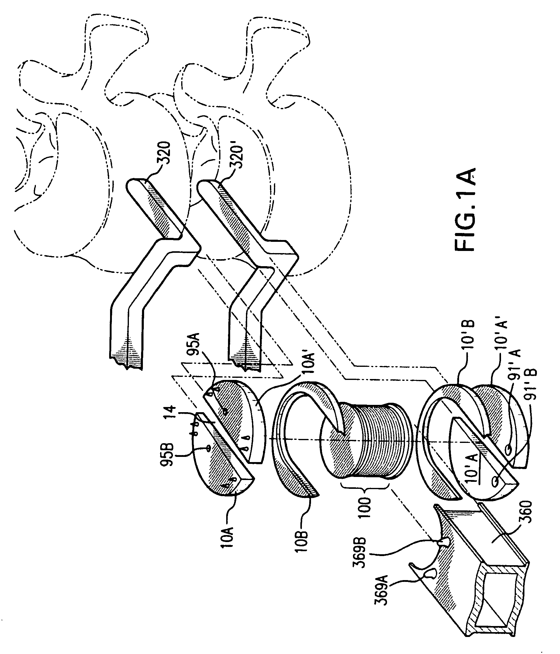 Compressible, rotatable, and tiltable hydraulic spinal disc prosthesis system with selectable modular components