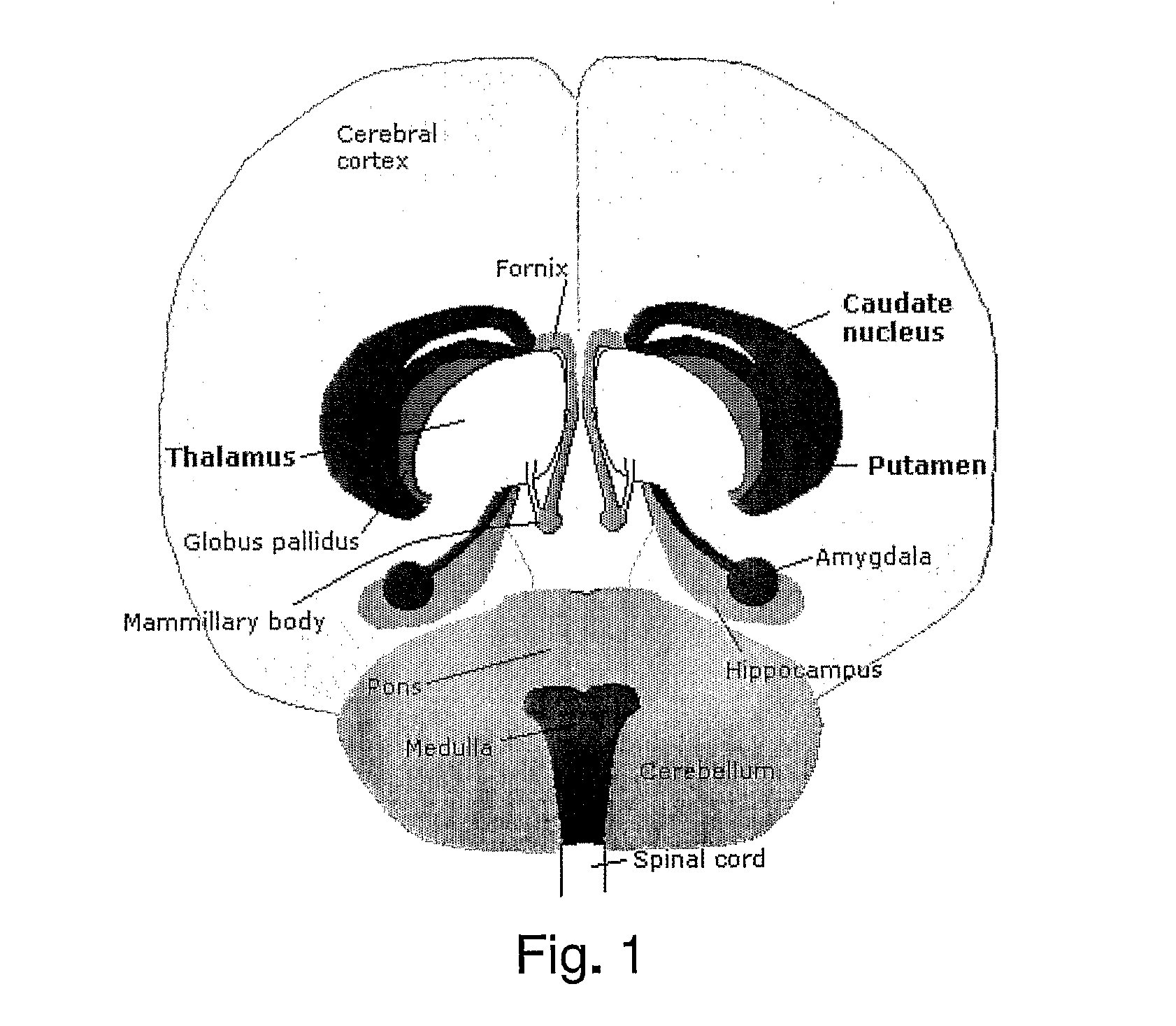 System and method for volumetric analysis of medical images