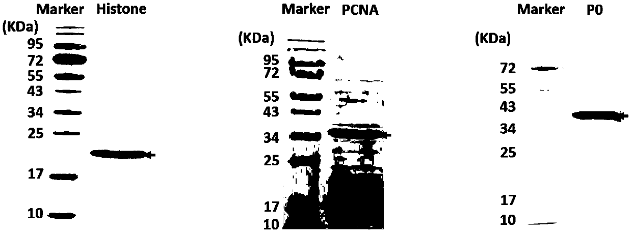 Antigen-immobilized matrix membrane, kit comprising the same for detecting antinuclear antibody spectrum related to autoimmune diseases and purpose thereof