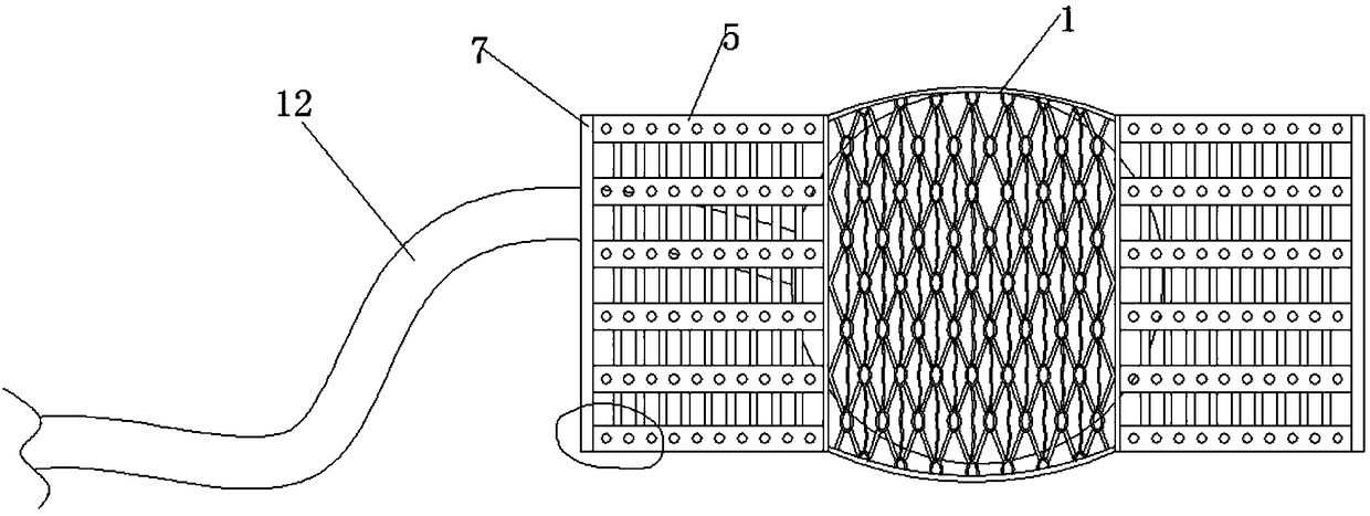 Vascular stent suitable for arterial vessels