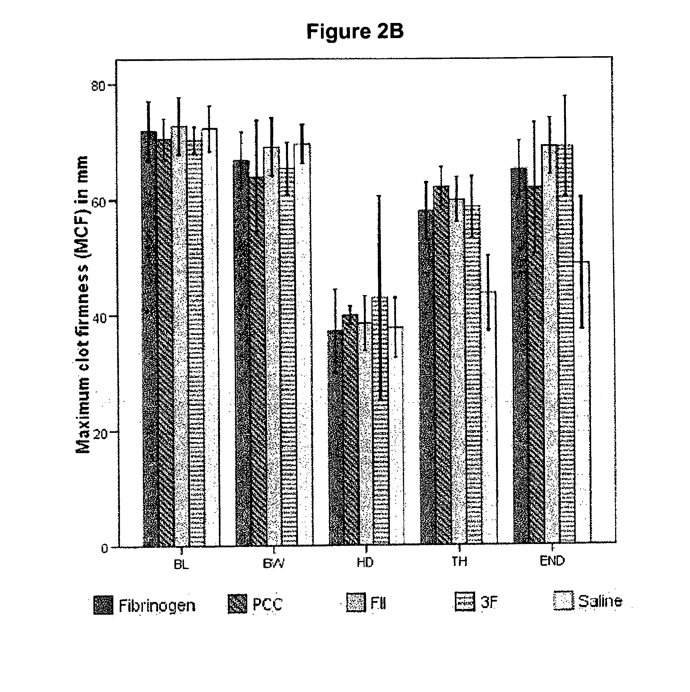 Factor ii and fibrinogen for treatment of haemostatic disorders