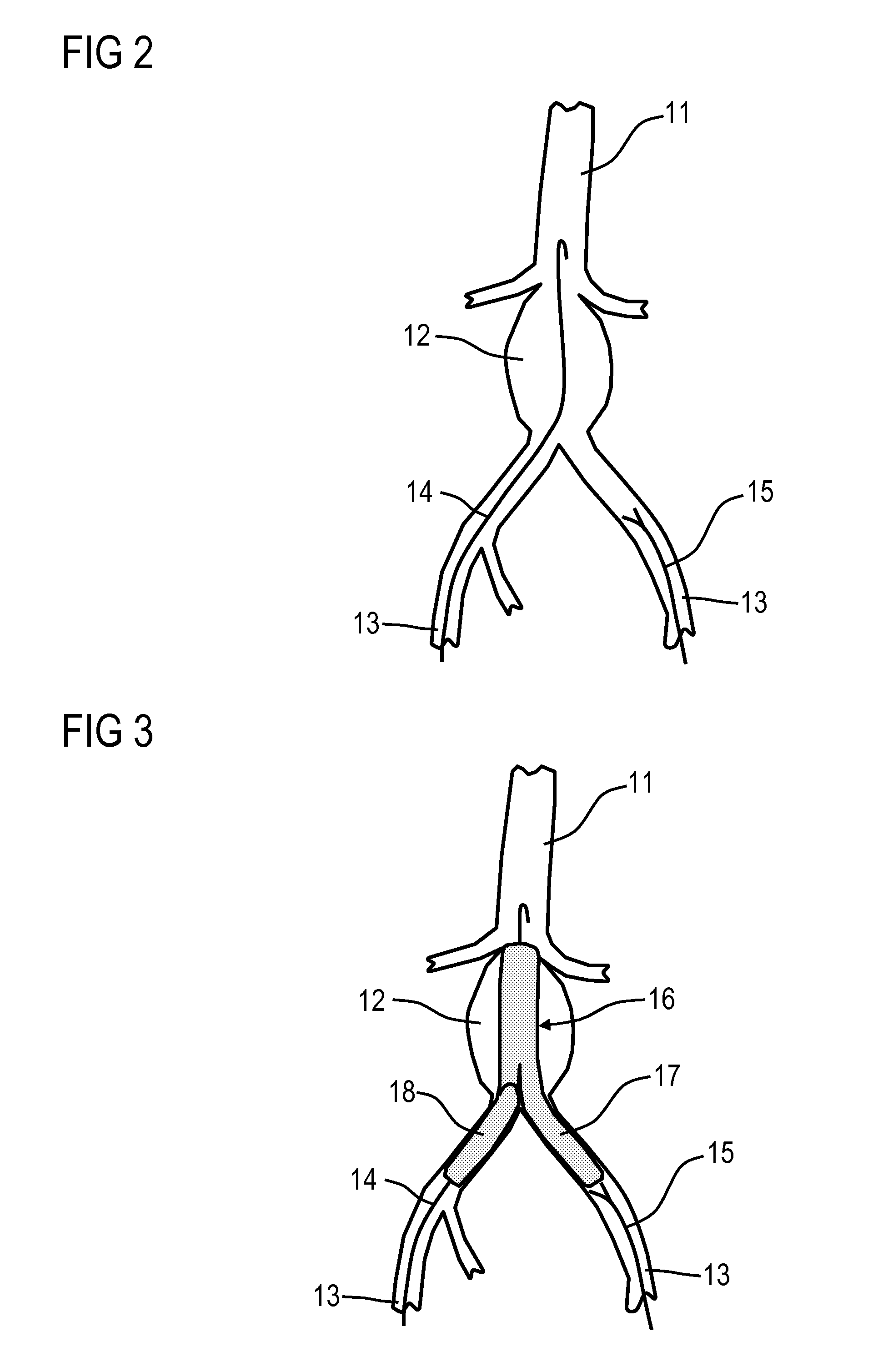 Angiography system for angiographic examination of an object under examination and angiographic examination method