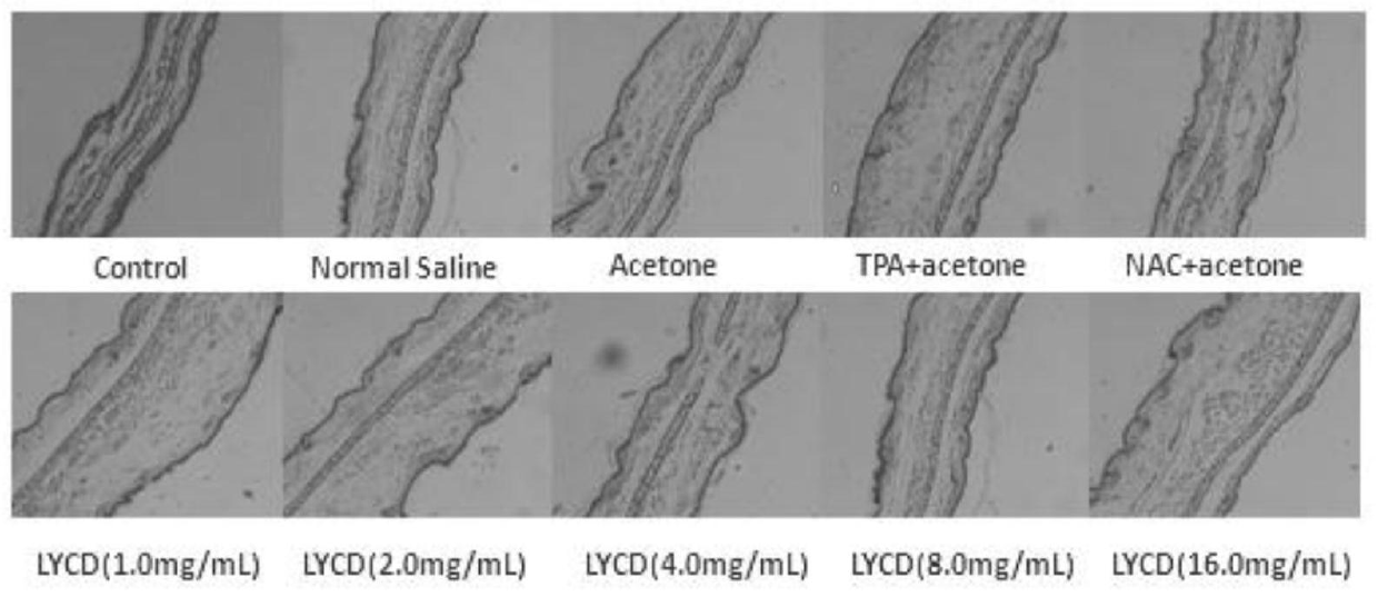 Anti-inflammatory effect of a yeast oxidative stress metabolite and its application