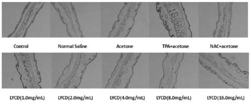 Anti-inflammatory effect of a yeast oxidative stress metabolite and its application