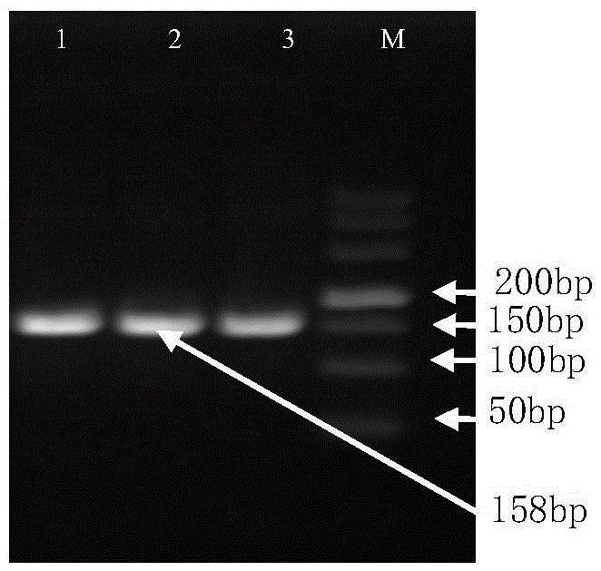 Real-time fluorescence quantification PCR detecting kit for cow mycoplasma and special primers and TaqMan probe thereof