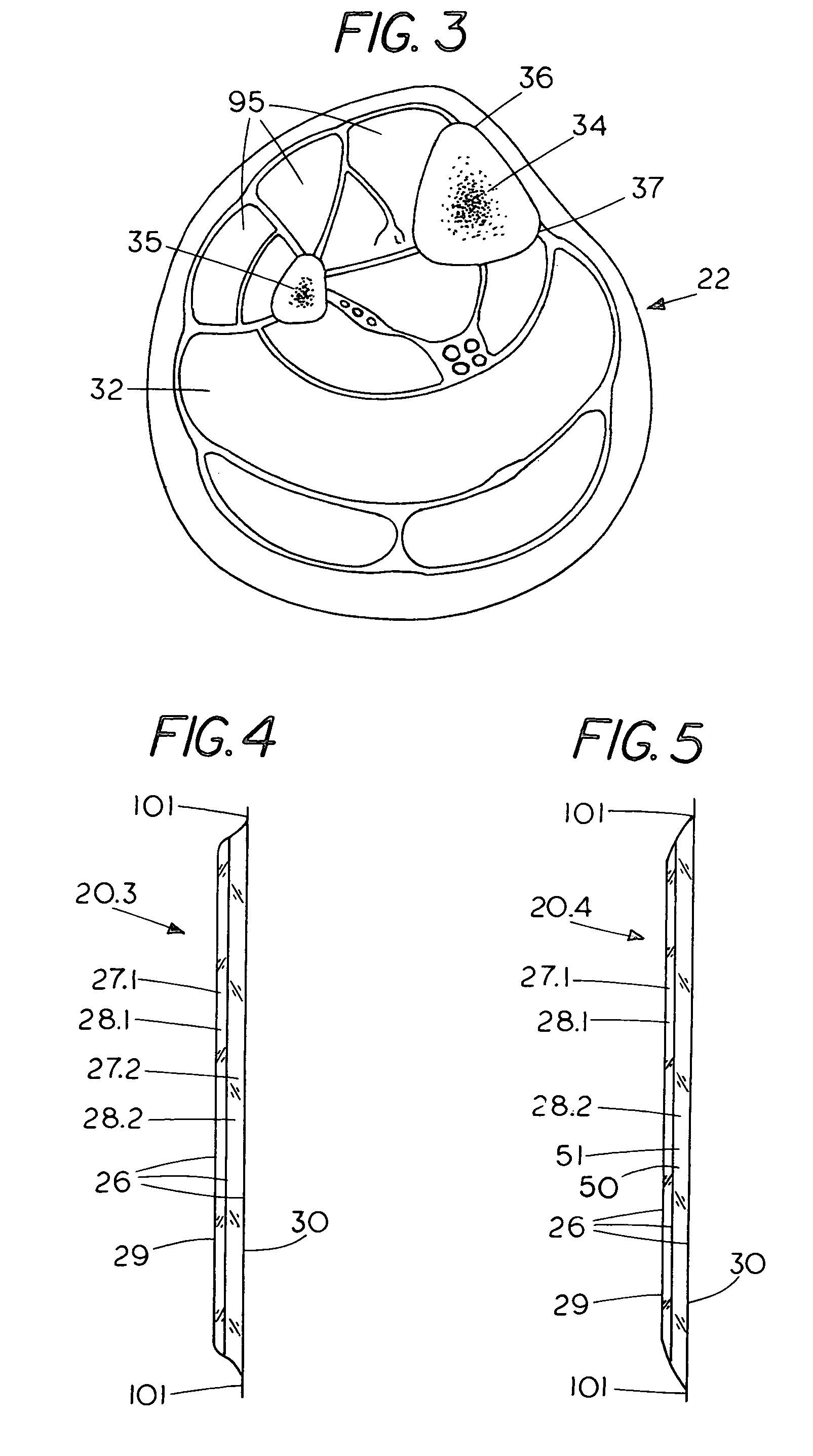 Shin-guard, helmet, and articles of protective equipment including light cure material